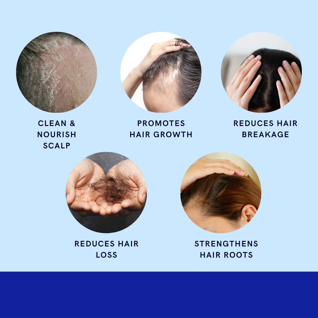 green royalty minoxidil shampoo unisex use on all hair types
