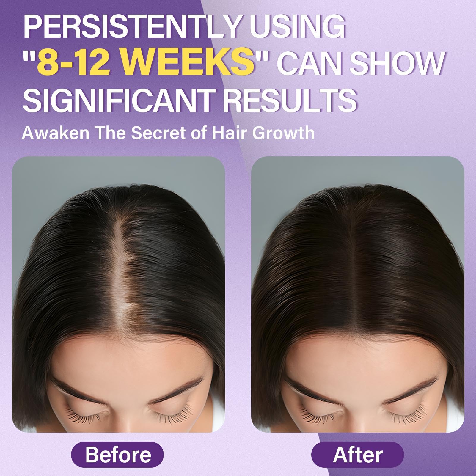 Greoay minoxidil foam pumps shown for targeted area application