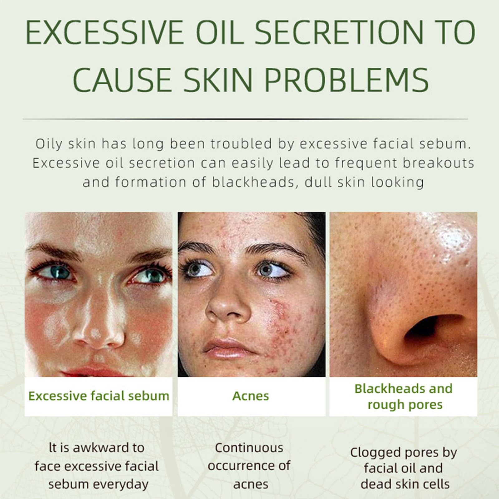 Grospe acne removing cream on the face demonstrates targeted acne care.