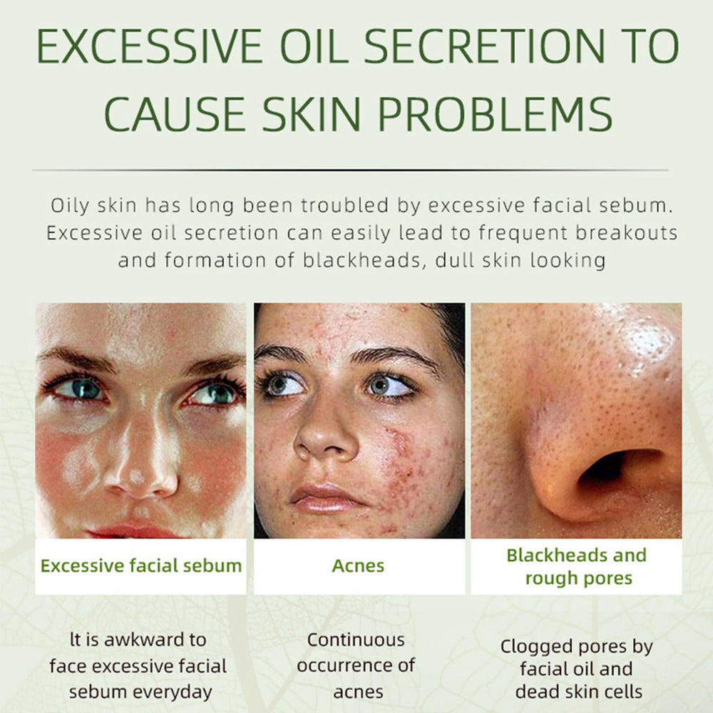 Grospe acne removing cream on the face demonstrates targeted acne care.