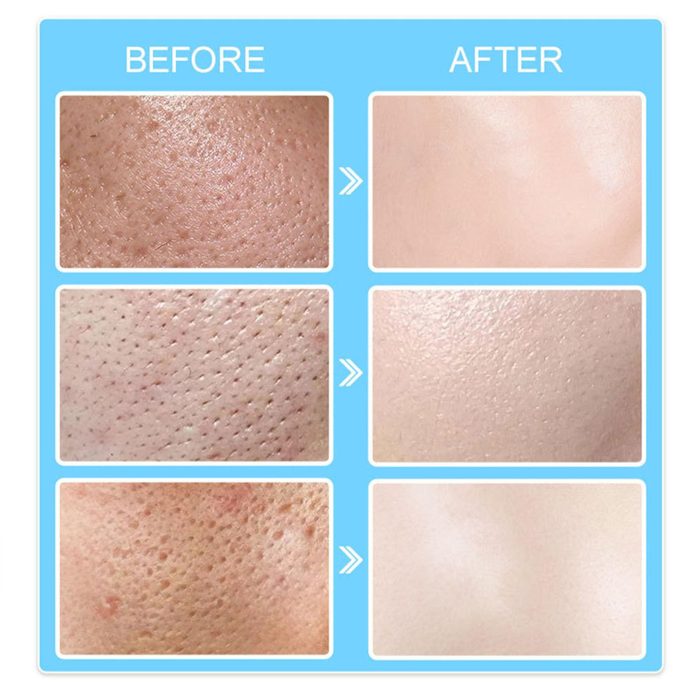 Grospe Pore Invisible Cream before and after to illustrate pore appearance.
