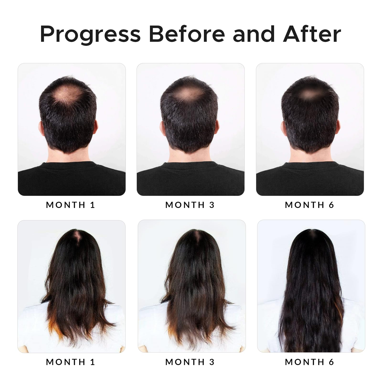 Growth Essence minoxidil-biotin shampoo ingredients-onion-green-tea captures antioxidant-rich blend for nourished-looking strands