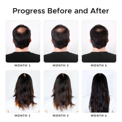 Growth Essence minoxidil-biotin shampoo ingredients-onion-green-tea captures antioxidant-rich blend for nourished-looking strands
