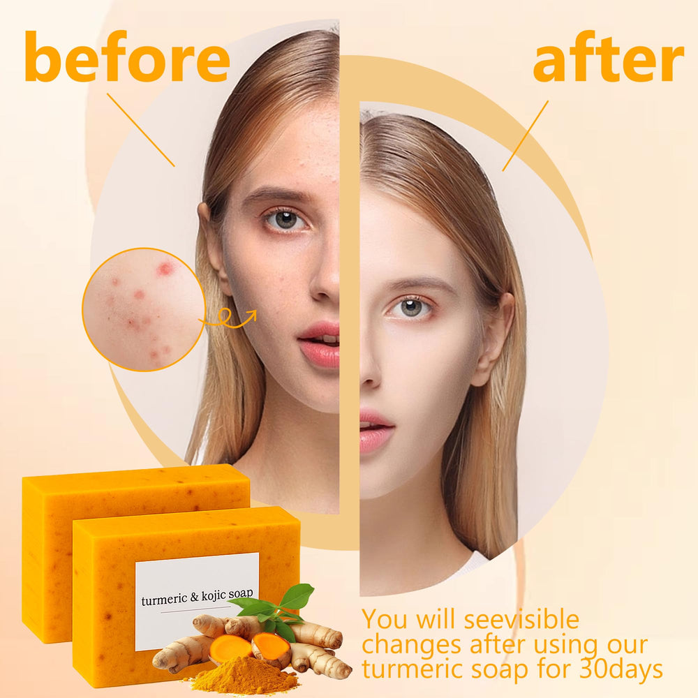 Guluxly Lemon Turmeric Kojic Soap lather demonstrates moisturizing action for everyday hydration.
