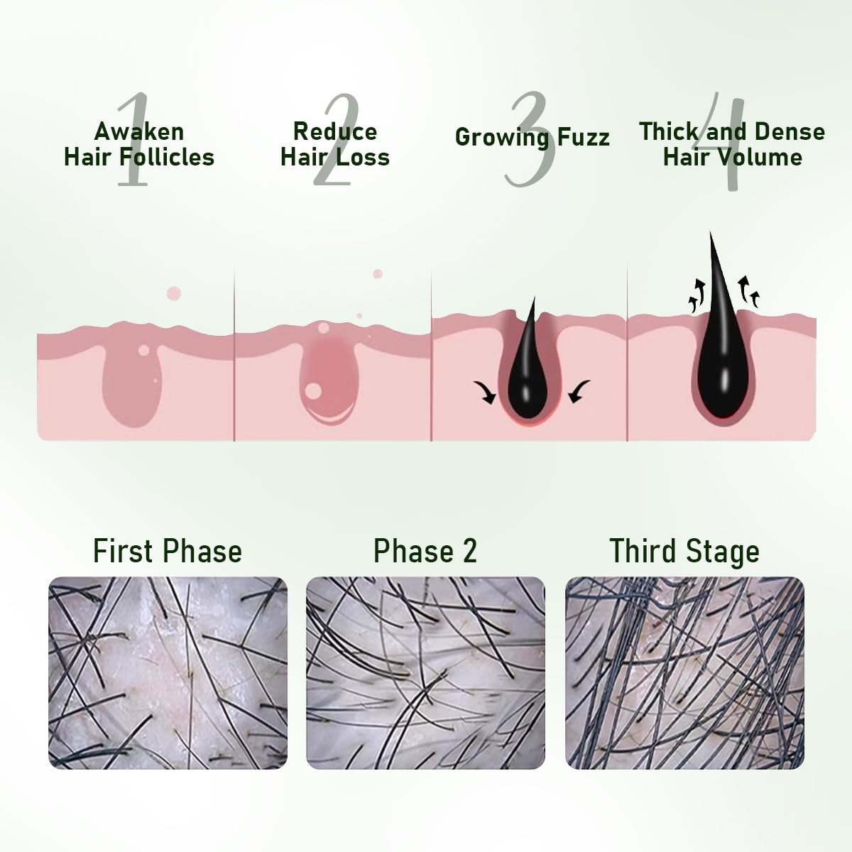 Gypsophila hair-growth-bundle-packaging covers wash and nourishment pairing