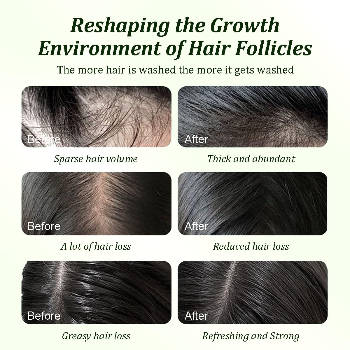 Gypsophila Batana Oil Shampoo sulfate-free label signaling gentle cleanse for sensitive scalps.