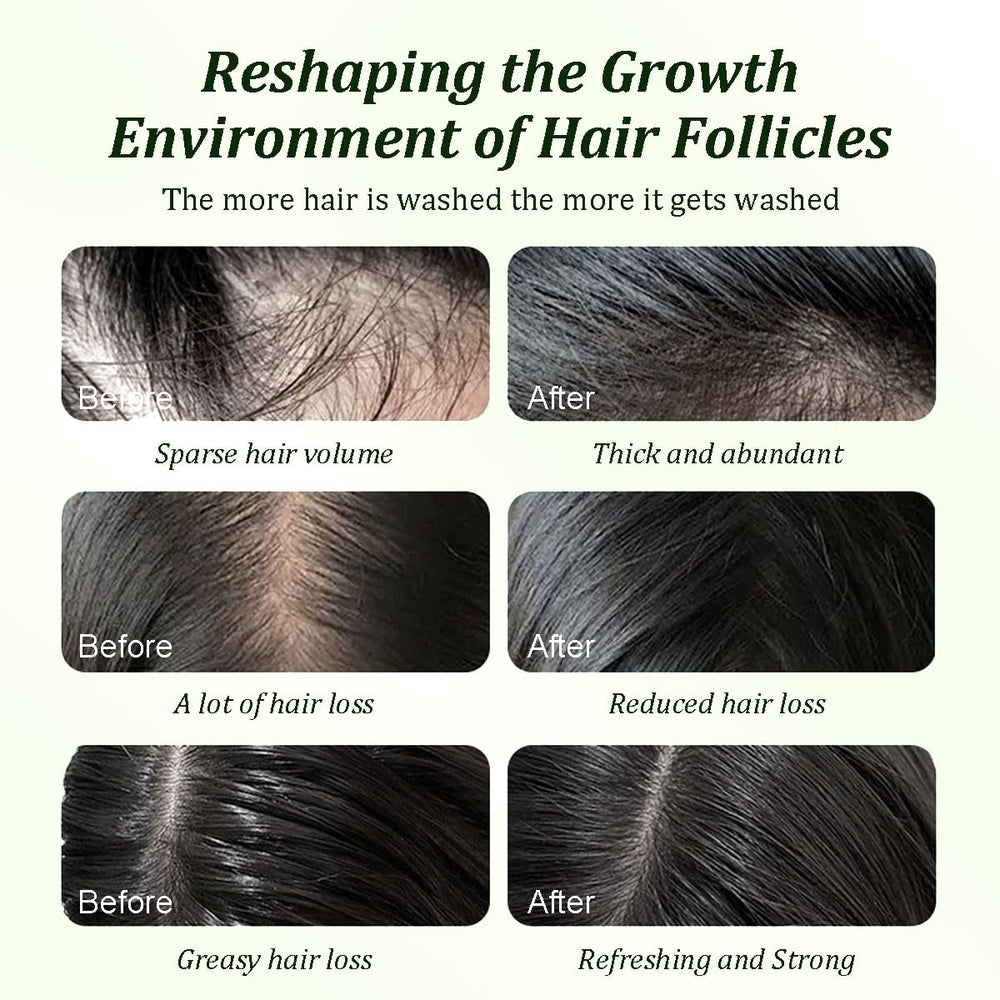Gypsophila Batana Oil Shampoo sulfate-free label signaling gentle cleanse for sensitive scalps.