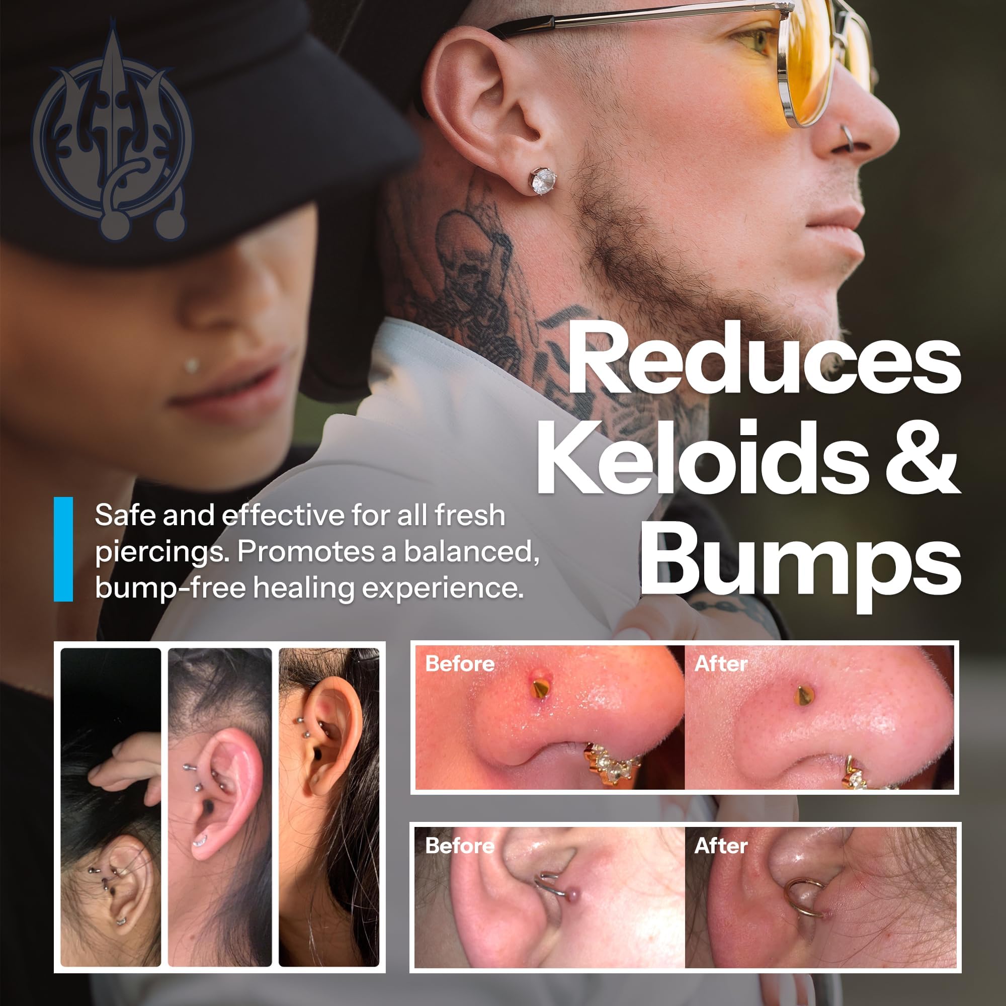 H2Ocean keloid-bump-removal illustration with soothing aftercare concept.