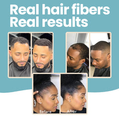 Hair Illusion application thinning scalp demonstrates targeted coverage.