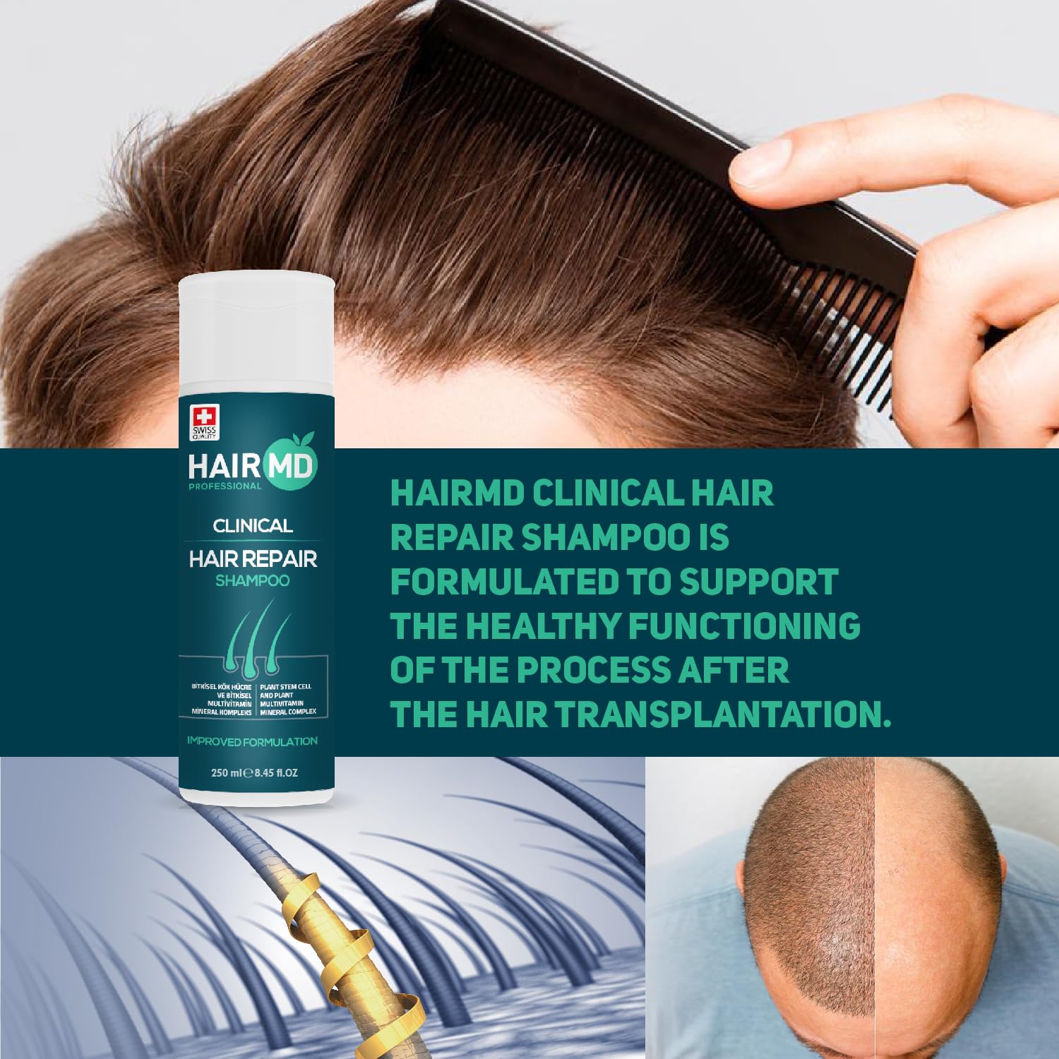HairMD scalp balance and dandruff control action shot