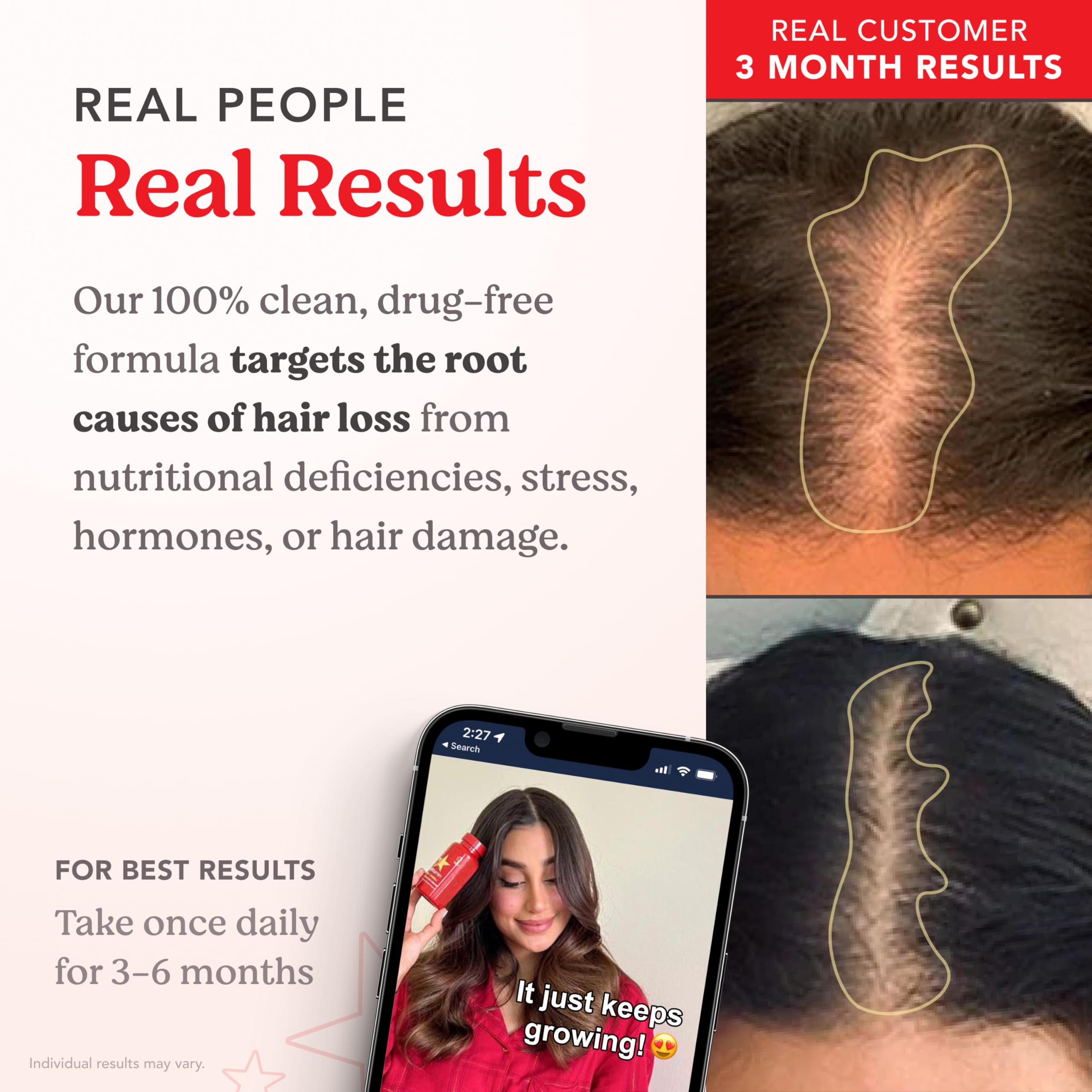 HAIRtamin Advanced Formula daily-dose imagery showing one capsule a day.