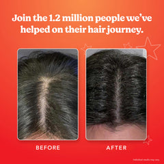 HAIRtamin Scalp Serum on scalp application demonstrates fast-absorbing, non-greasy hydration.