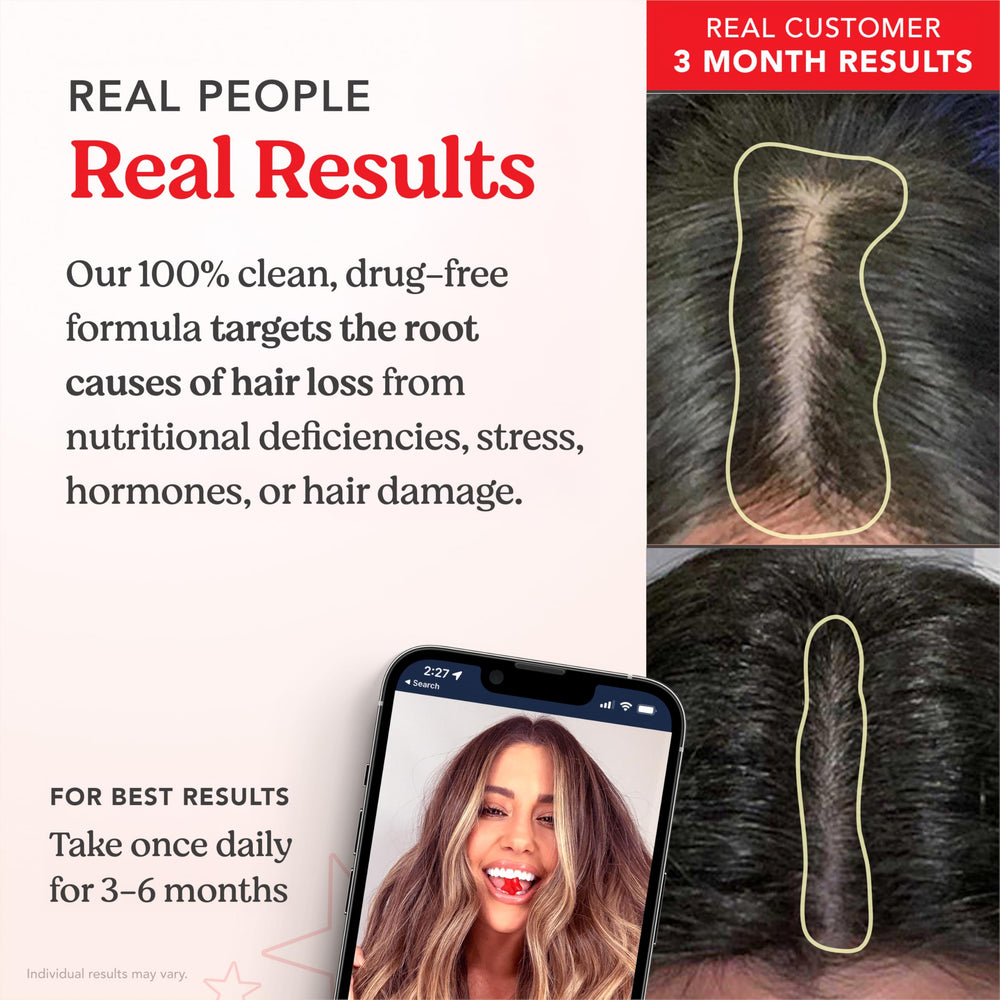HAIRtamin Vegan Gummy Stars ingredients—vegan nutrients for hair nourishment.