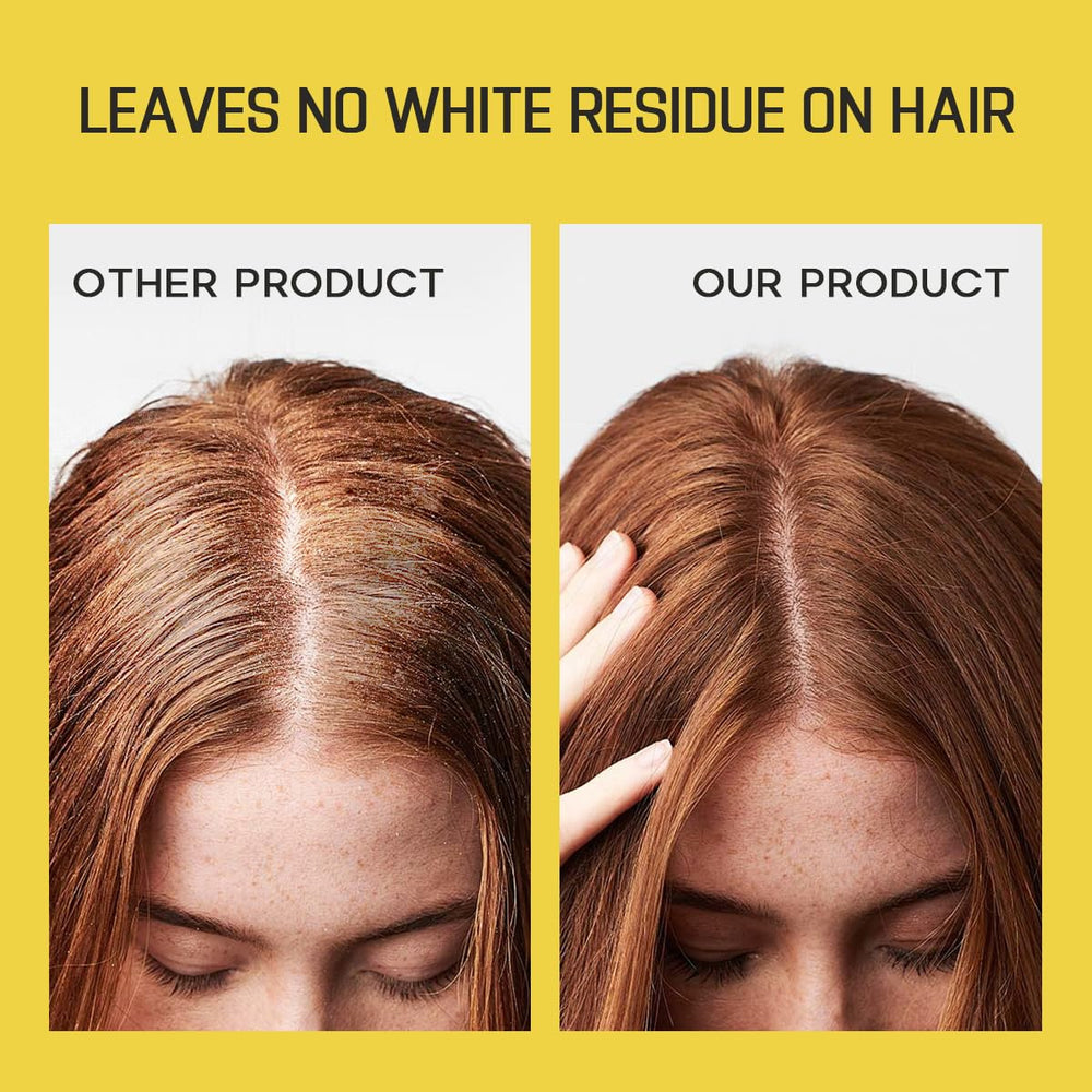 HALOVIDA absorbs oil and refreshes hair without heaviness.