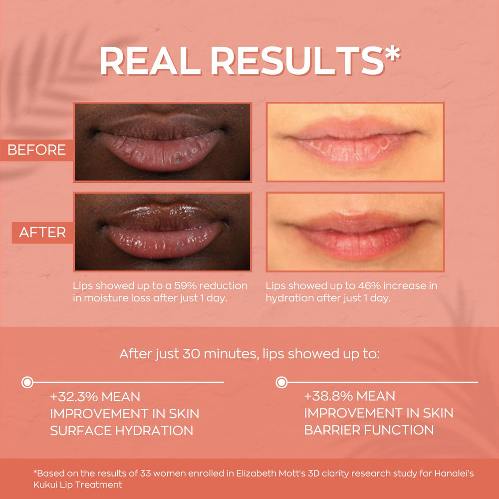 Hanalei lip treatment full-size 15g packaging displayed.