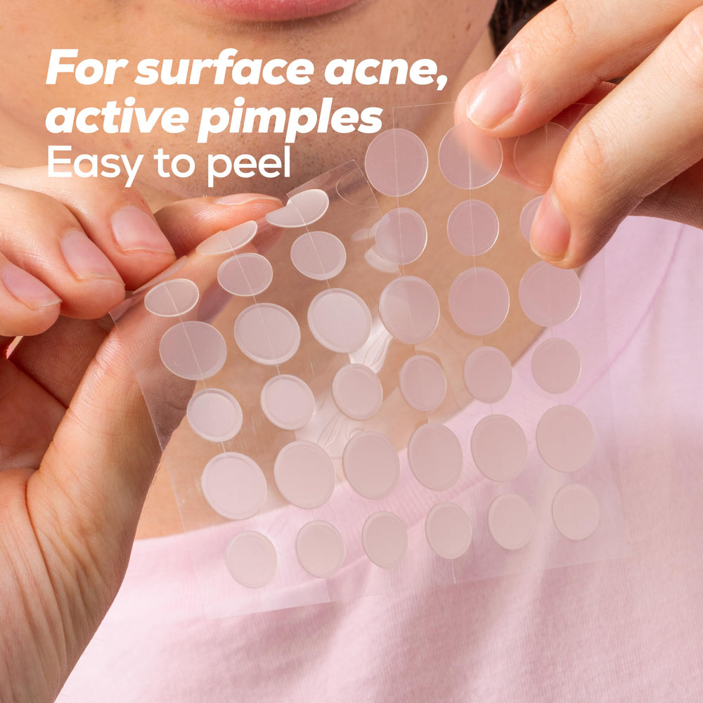 HANHOO blemish patch 12mm size — larger coverage for bigger blemishes.