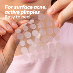 HANHOO blemish patch 12mm size — larger coverage for bigger blemishes.