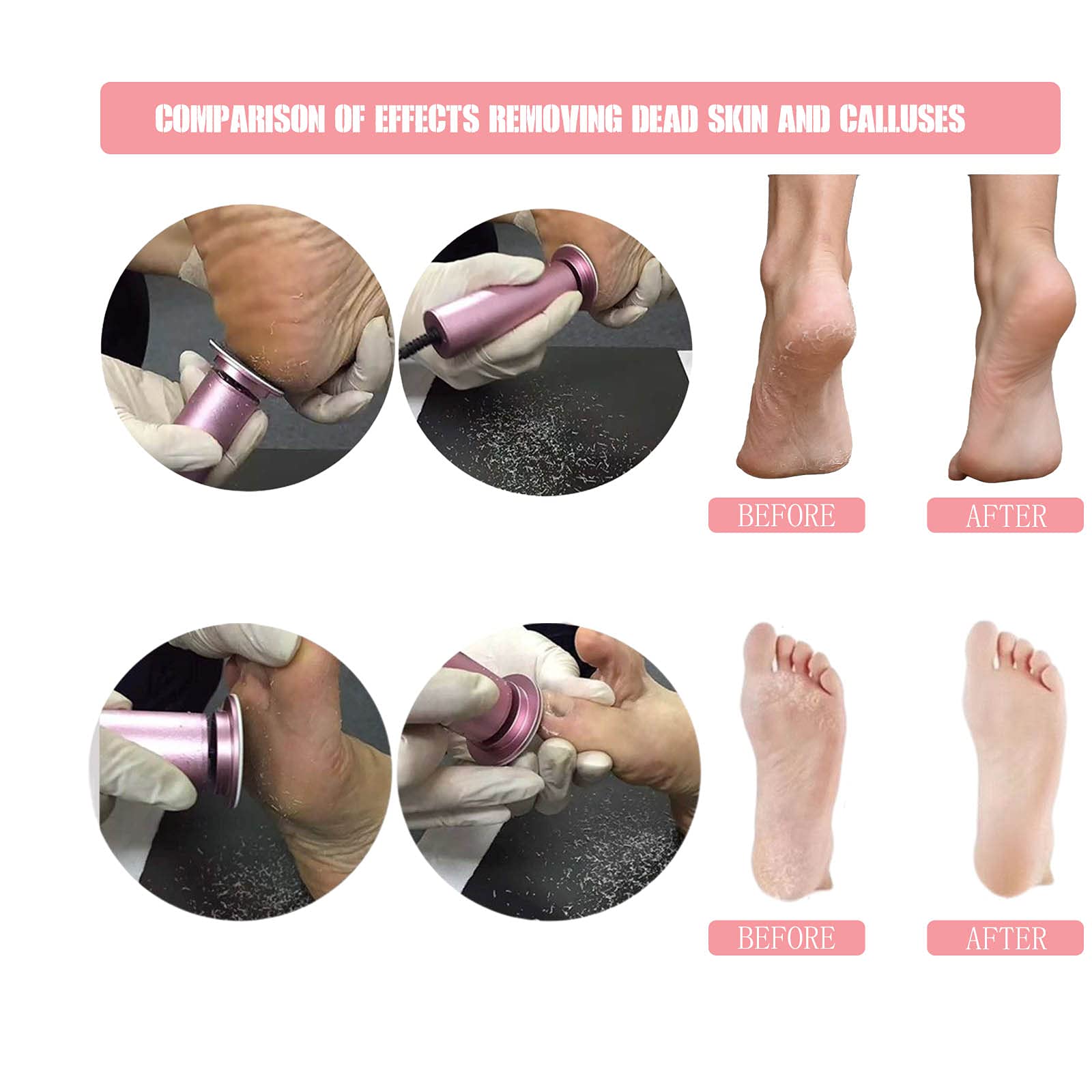 Hannah-Qi foot file handle-grip highlights comfortable ergonomic grip during foot care sessions