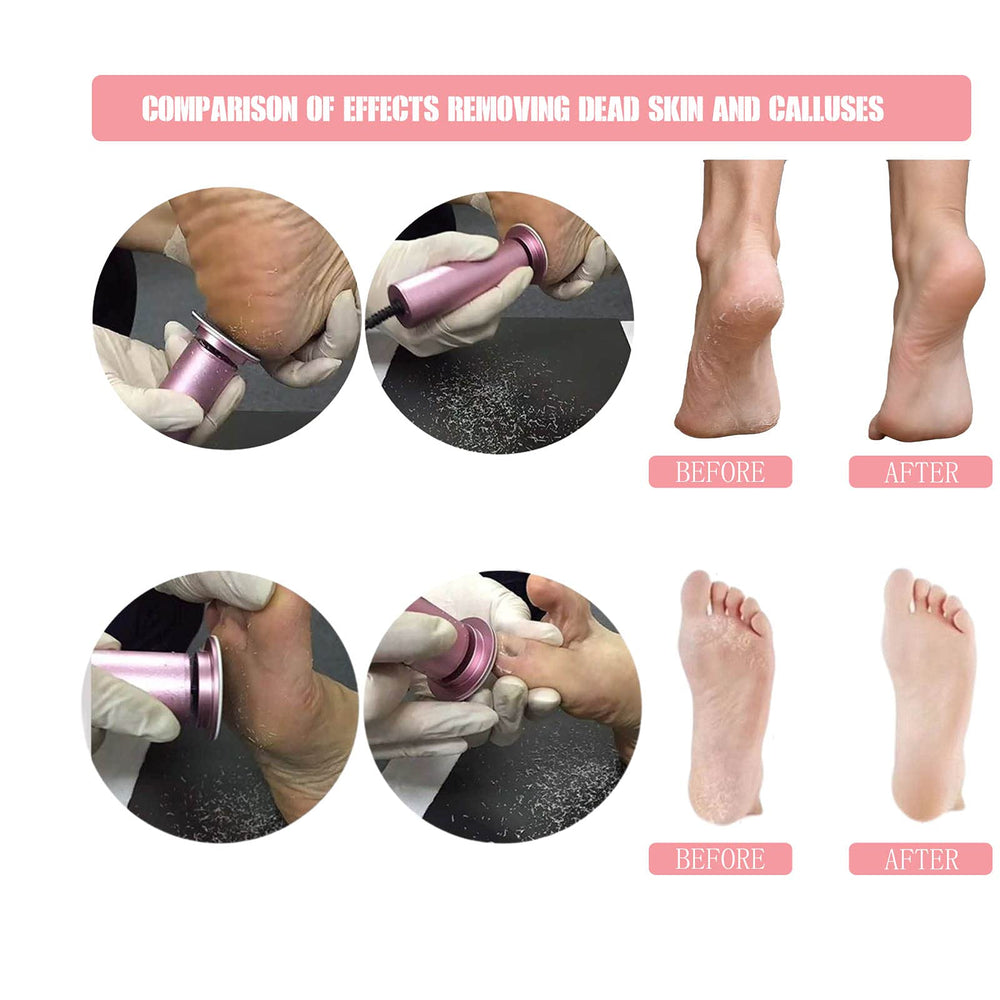Hannah-Qi foot file handle-grip highlights comfortable ergonomic grip during foot care sessions