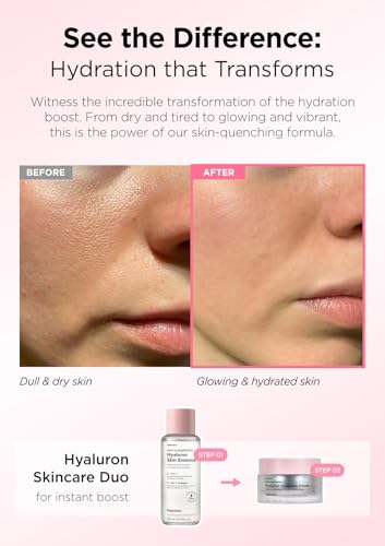 Hanskin Hyaluron Moisture Cream bottle display emphasizing quick absorption and daily hydration