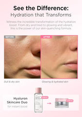 Hanskin Hyaluron Moisture Cream bottle display emphasizing quick absorption and daily hydration