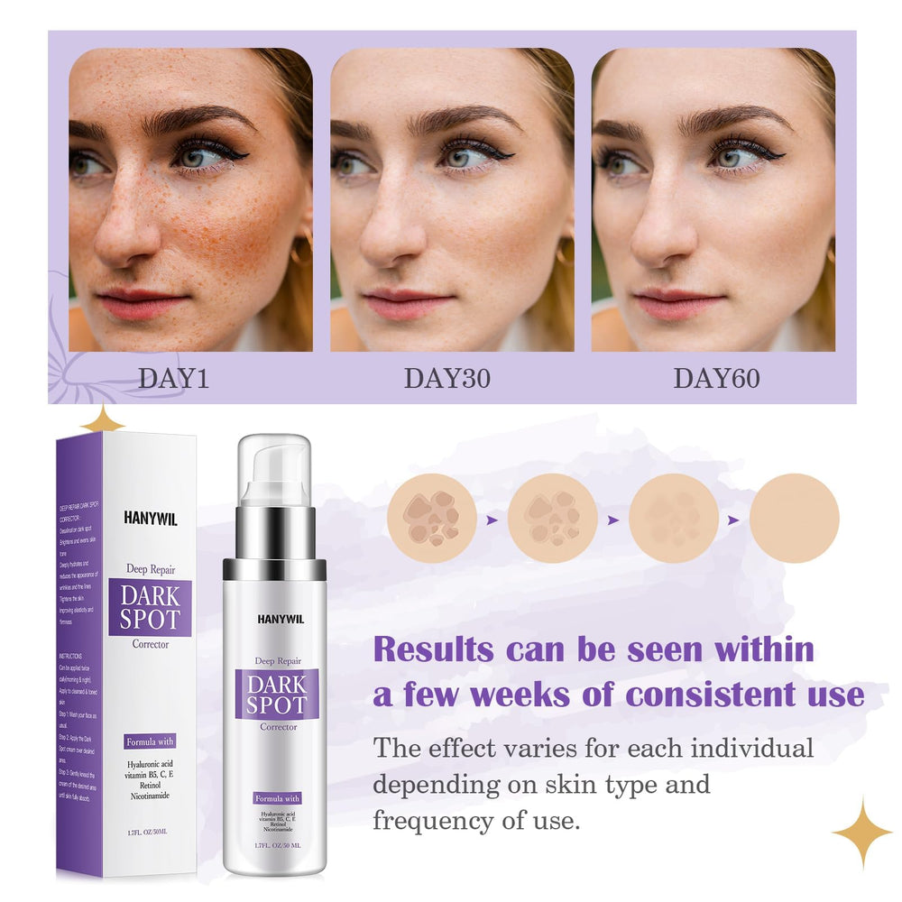 HANYWIL Dark Spot Remover application closeup indicates twice-daily routine.