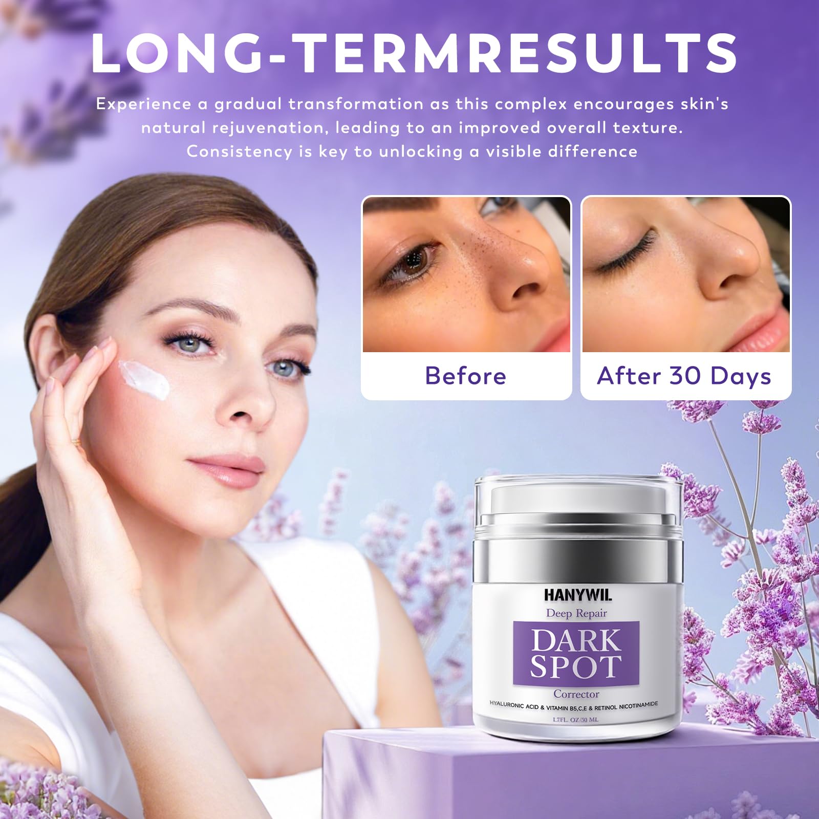 HANYWIL Dark Spot Remover serum dropper brightening facial discoloration.