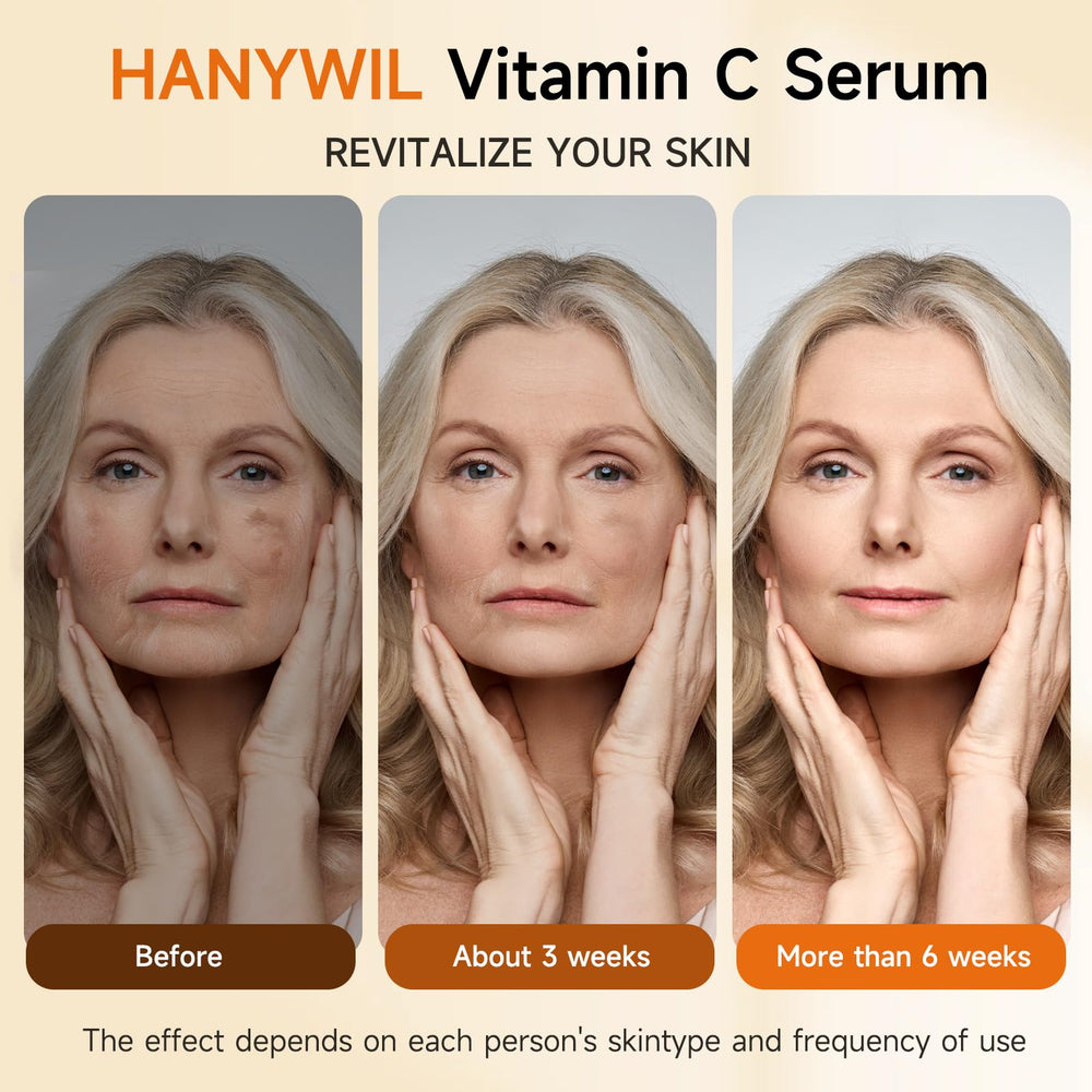 HANYWIL hyaluronic acid hydration emphasis on refreshed skin