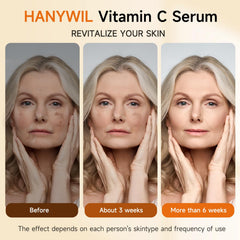 HANYWIL hyaluronic acid hydration emphasis on refreshed skin