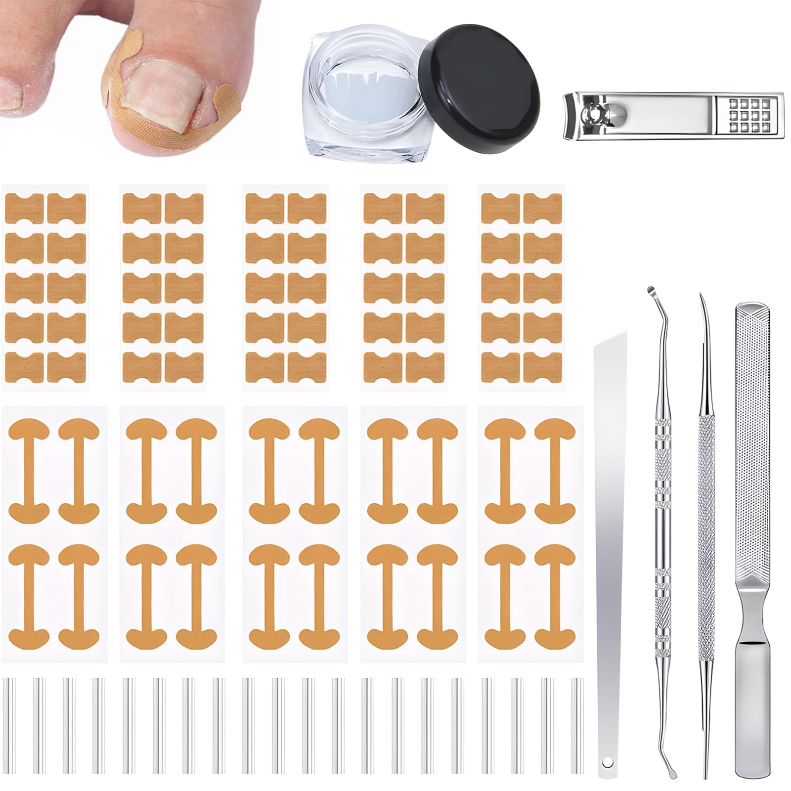HDFDREO ingrown toenail corrector set packaging highlights a comprehensive home-care kit.