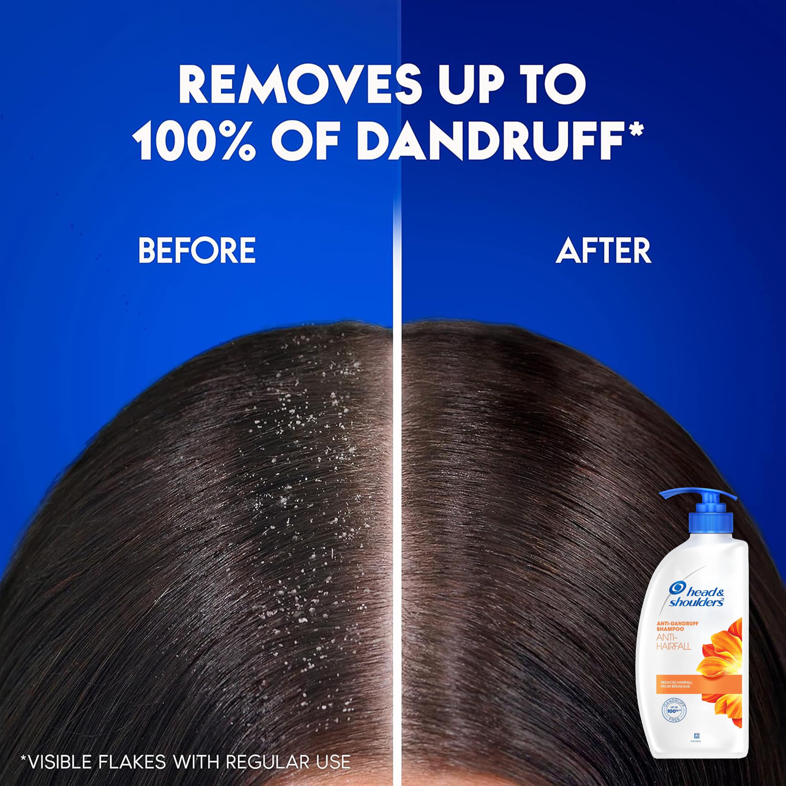 Head & Shoulders anti-dandruff care in family-friendly packaging supports shared routines.