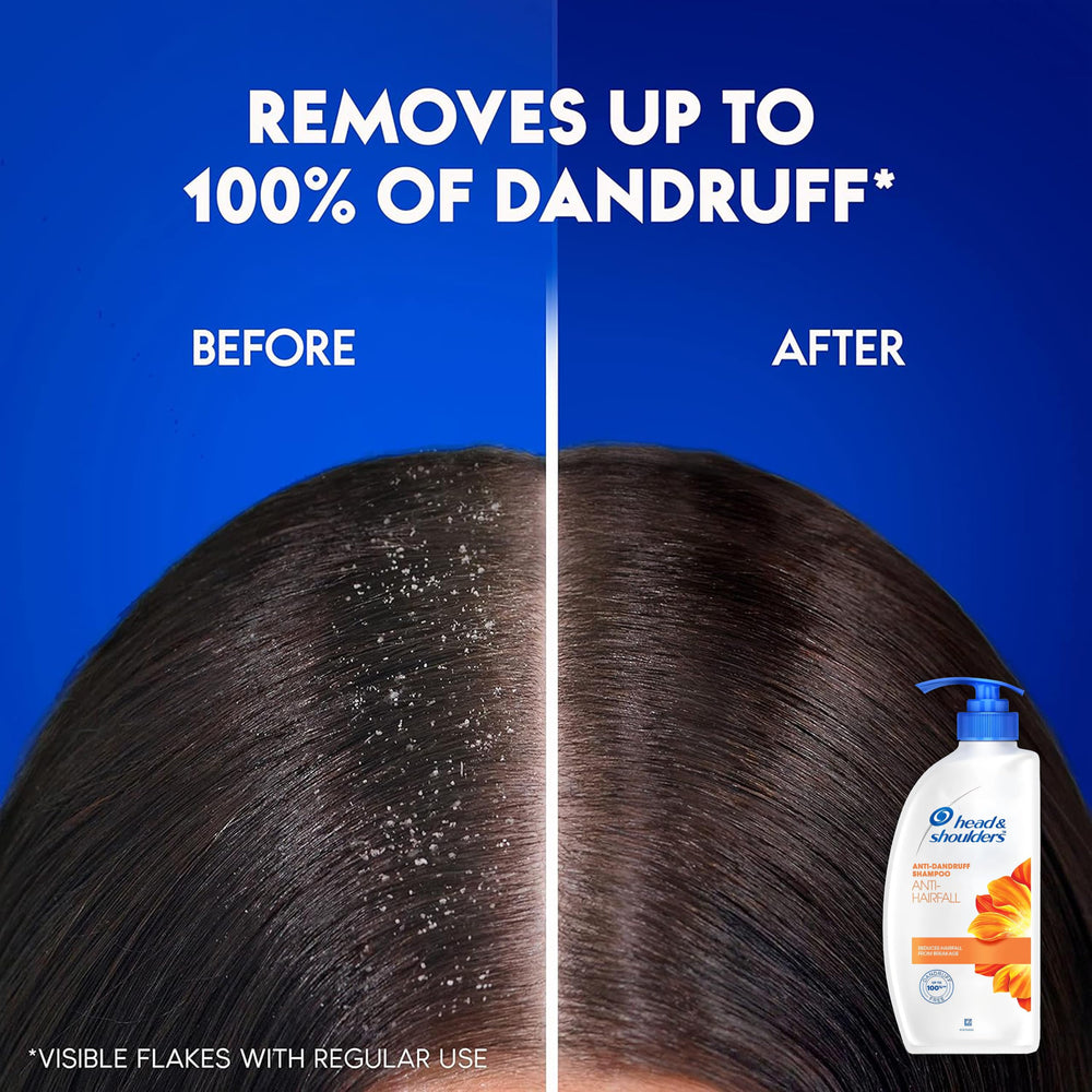 Head & Shoulders anti-dandruff care in family-friendly packaging supports shared routines.