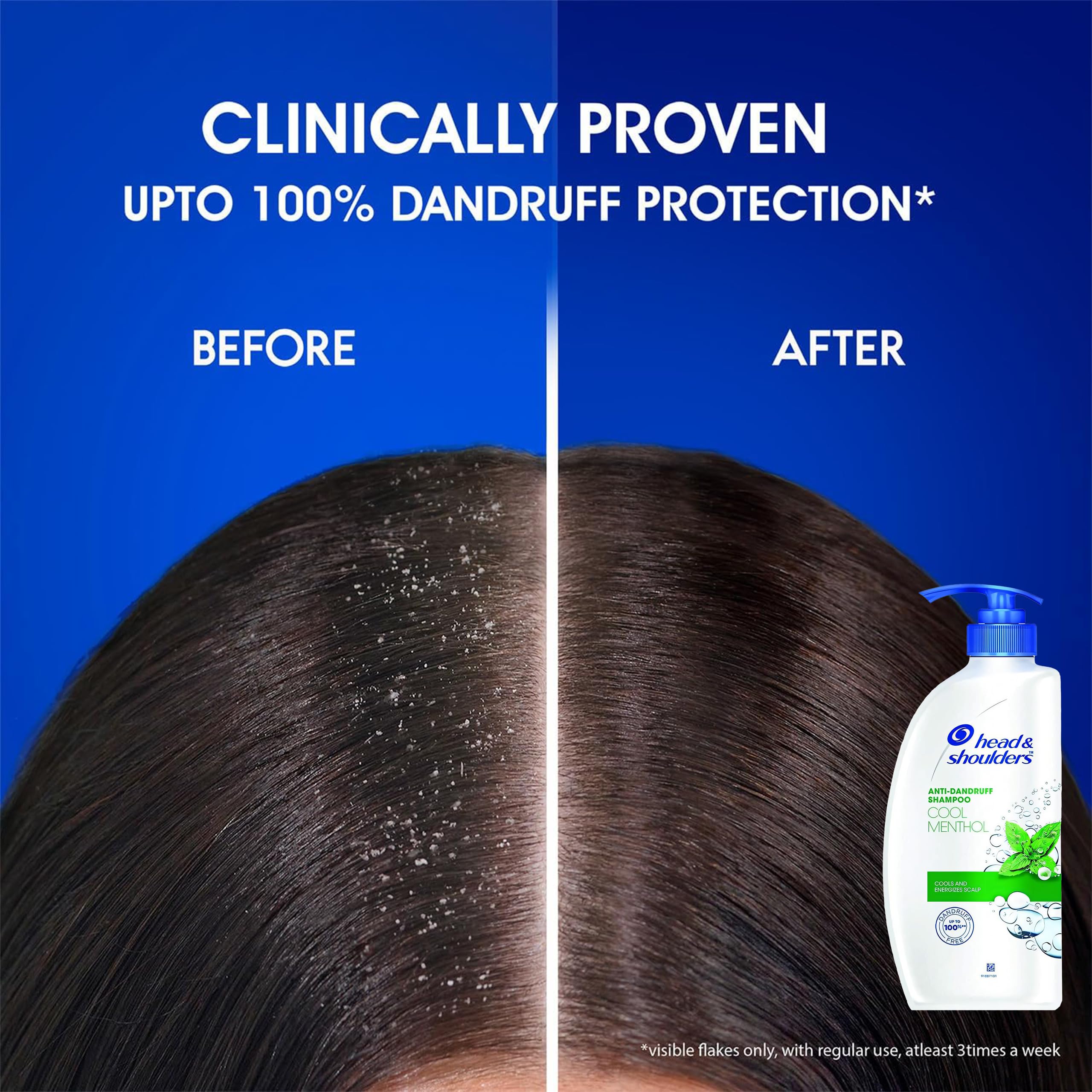 Head & Shoulders dermatologist-recommended badge on bottle reinforces trusted dandruff care.