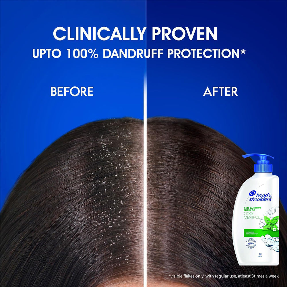 Head & Shoulders dermatologist-recommended badge on bottle reinforces trusted dandruff care.