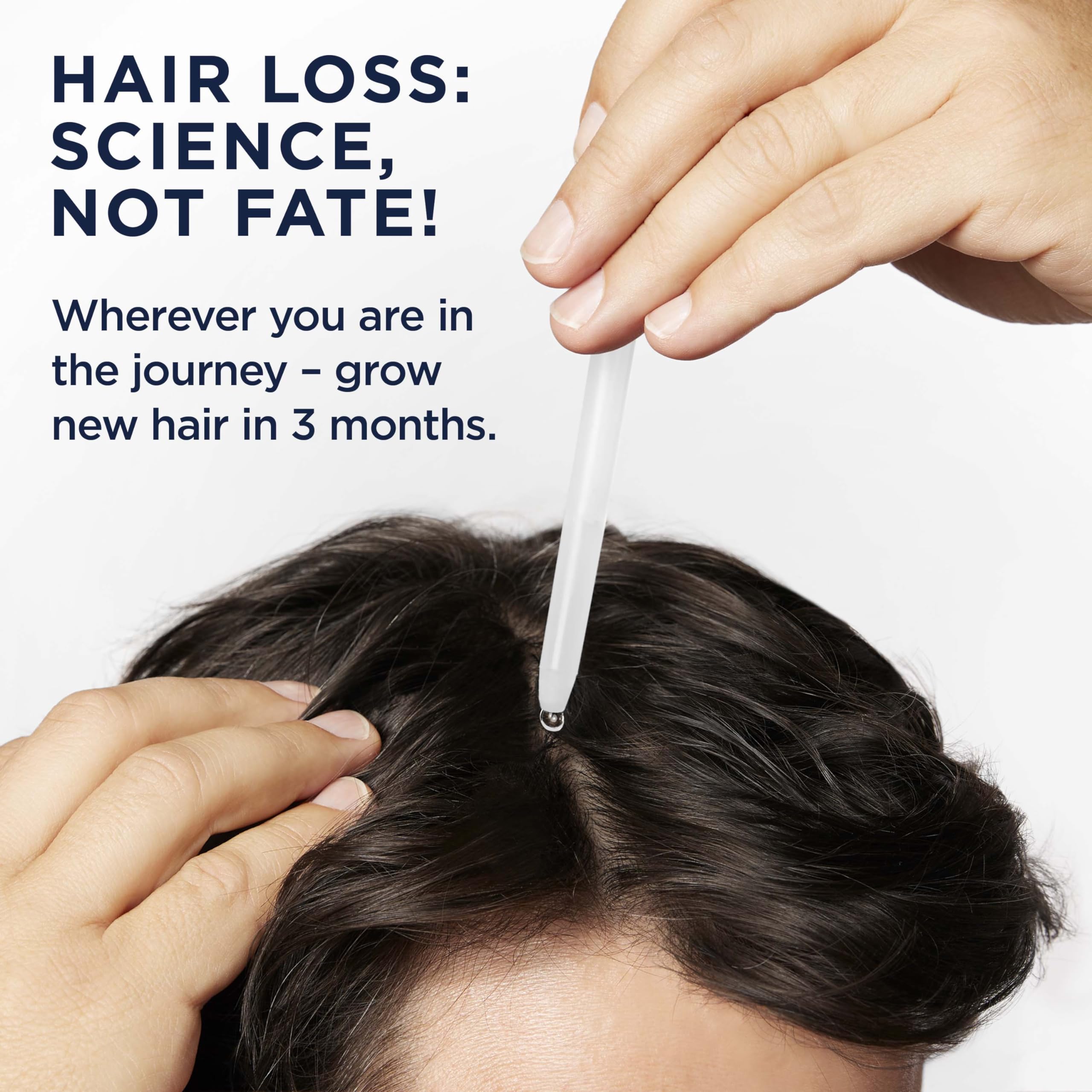 Head & Shoulders Scalp X top-of-head coverage focus on targeted scalp application.