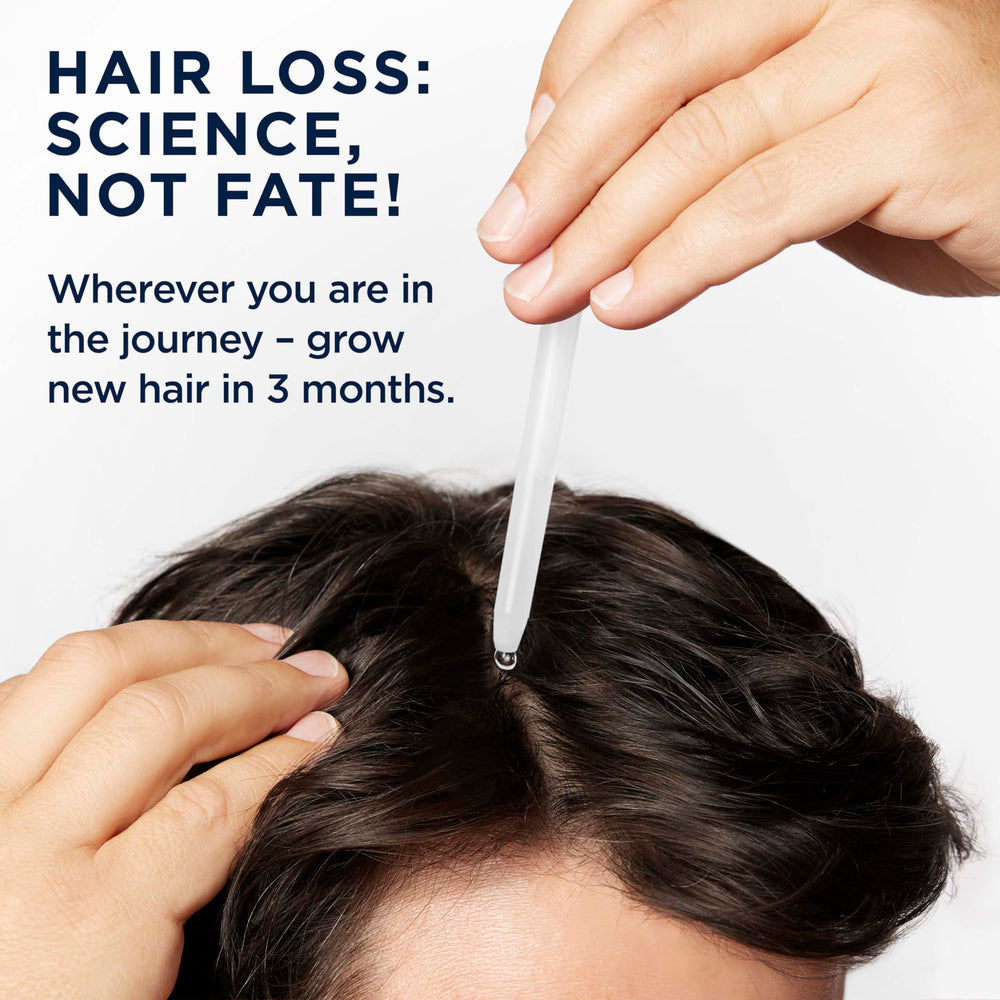 Head & Shoulders Scalp X top-of-head coverage focus on targeted scalp application.