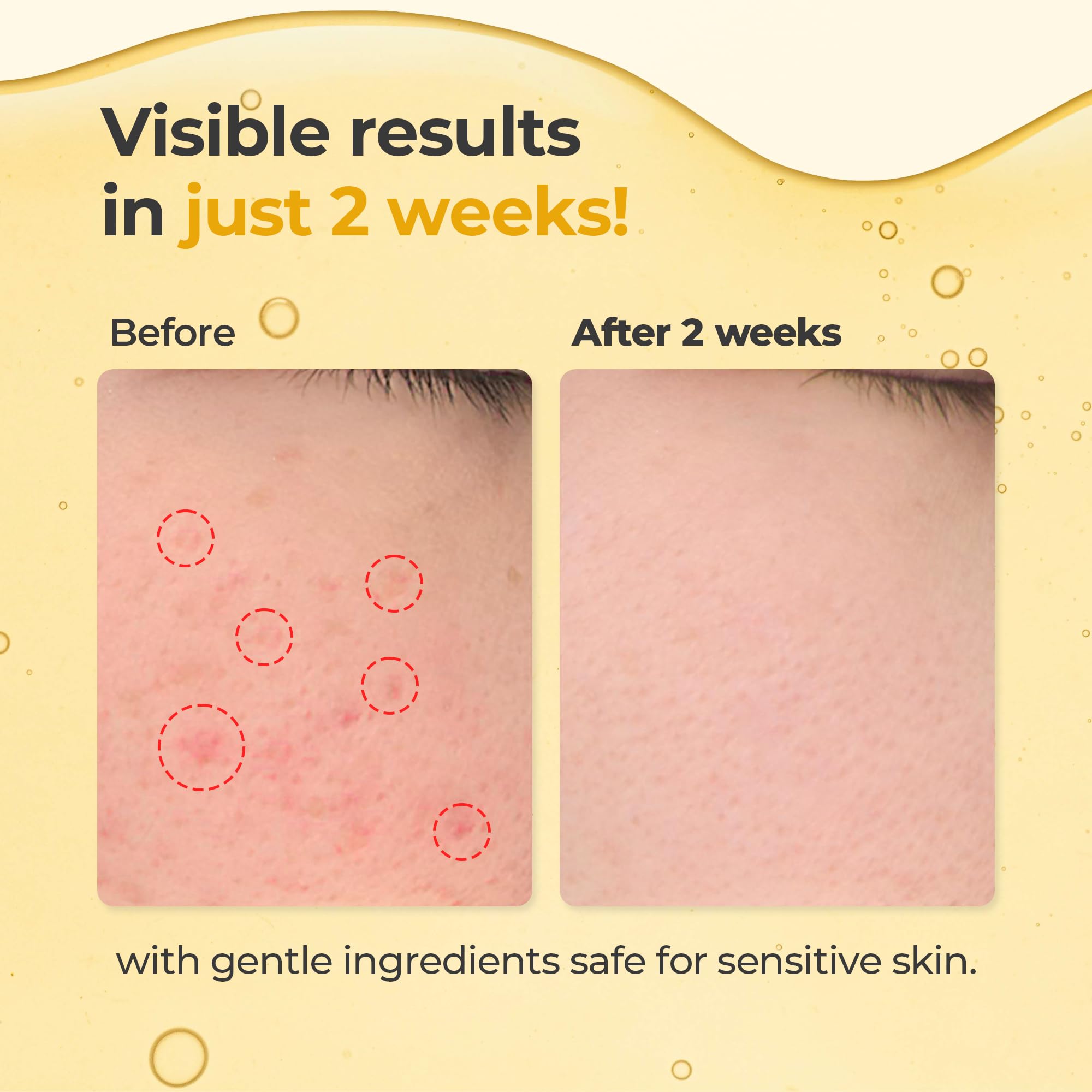 HEEDA Turmeric botanical extracts provide antioxidants and a calming skin sensation.