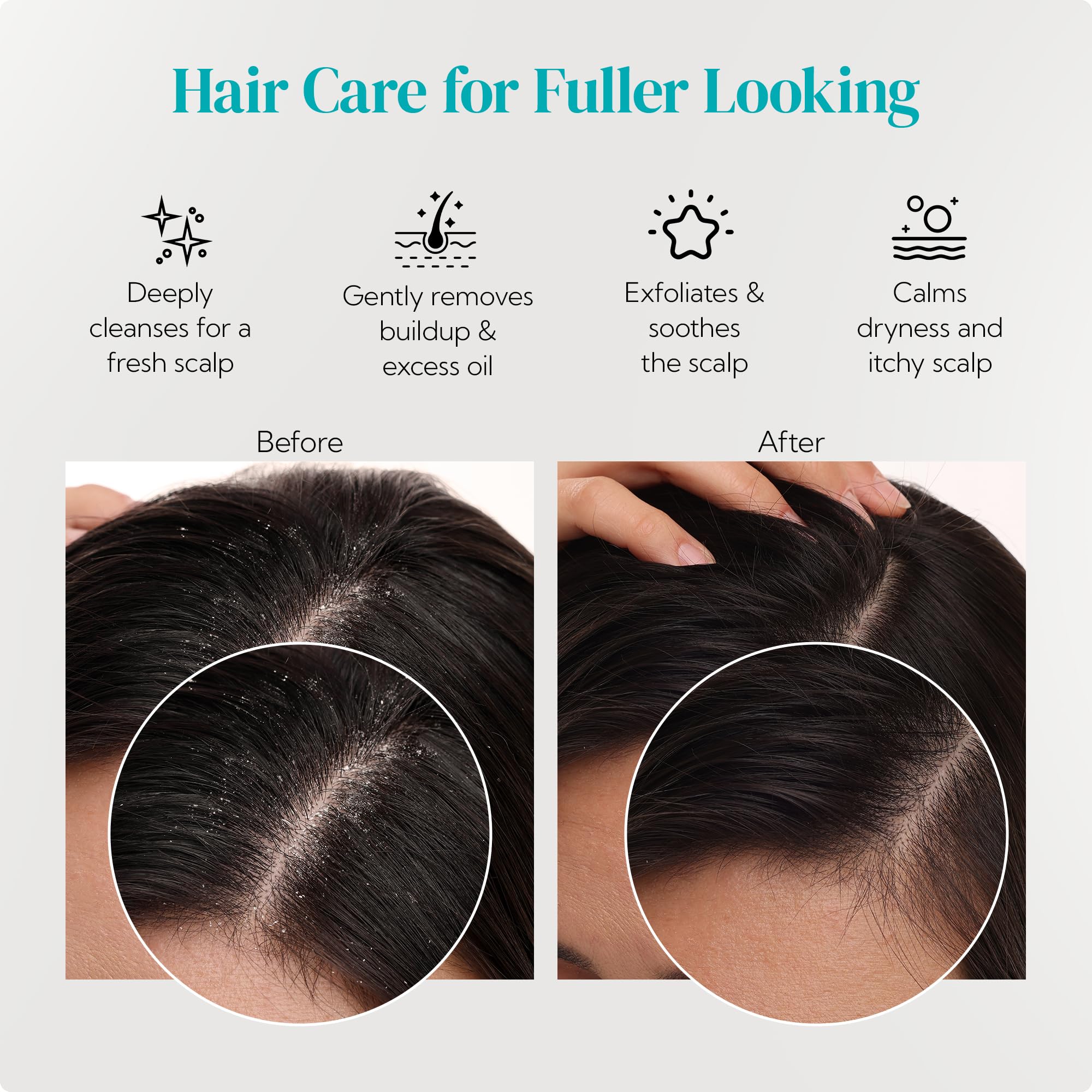 HEETA scalp massager easy-grip handle supports comfortable use during massage.