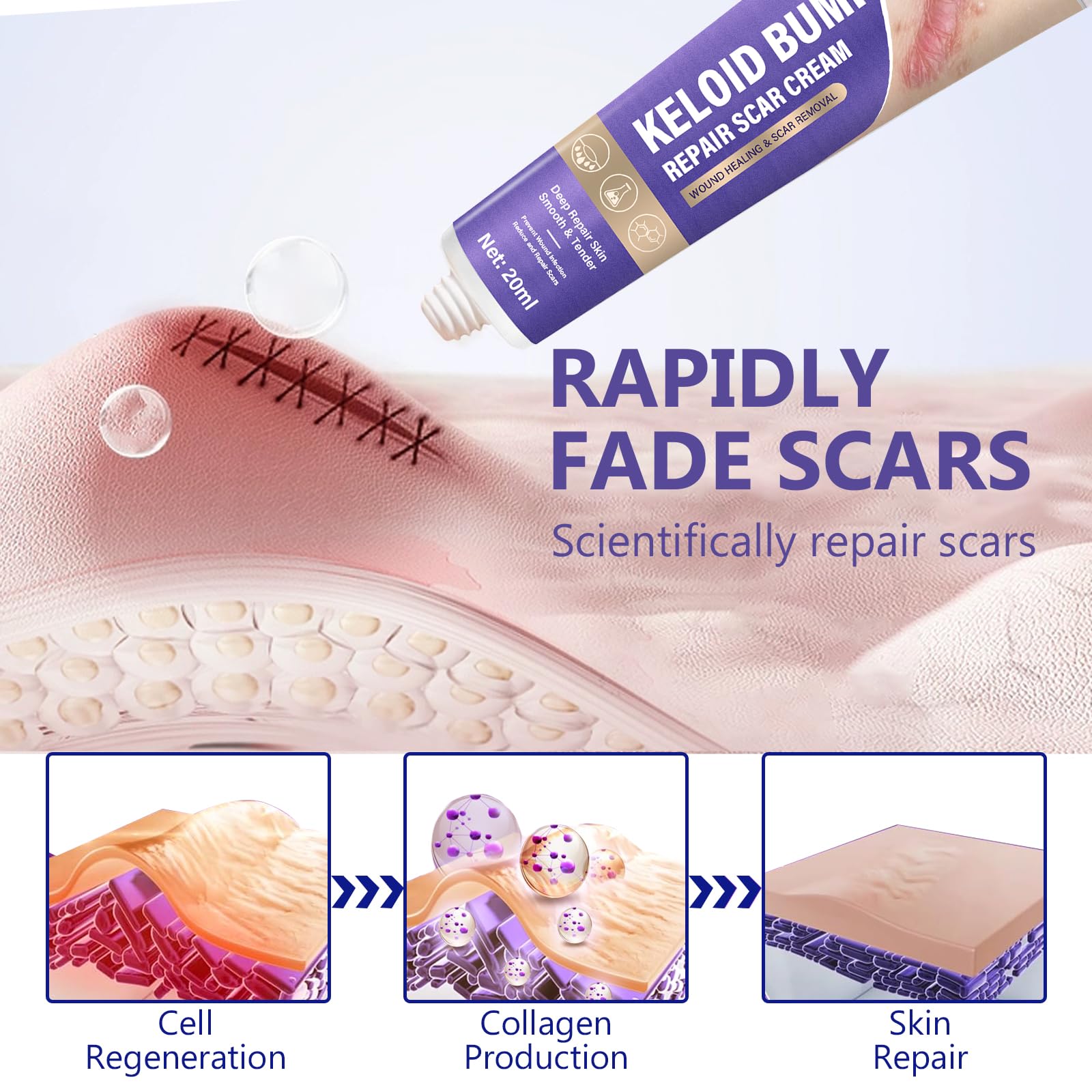 Hemir Keloid Bump Removal Cream application-spot demonstrates smooth fingertip glide for daily use.