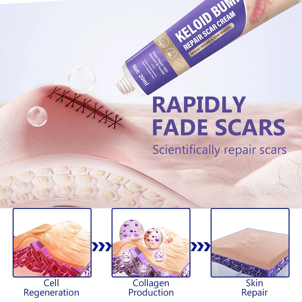 Hemir Keloid Bump Removal Cream application-spot demonstrates smooth fingertip glide for daily use.