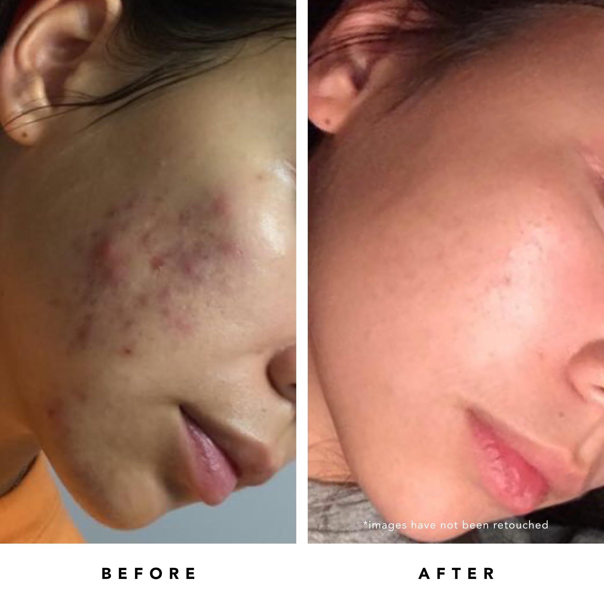 HERBIVORE Blue Tansy mask pore refinement highlights smoother-looking pores.