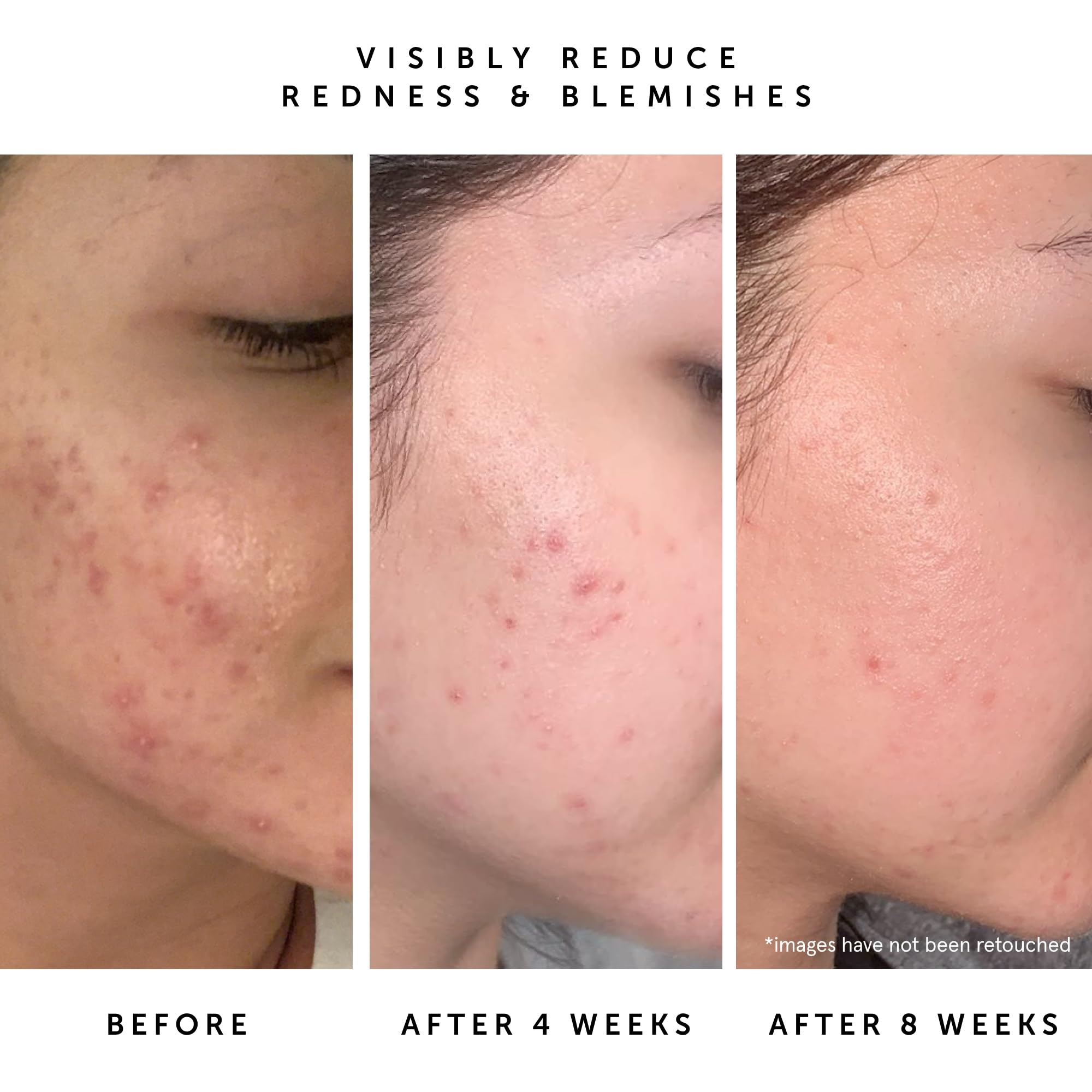 HERBIVORE Lapis Oil ingredient-squalane image communicates deep hydration with a non-greasy feel.