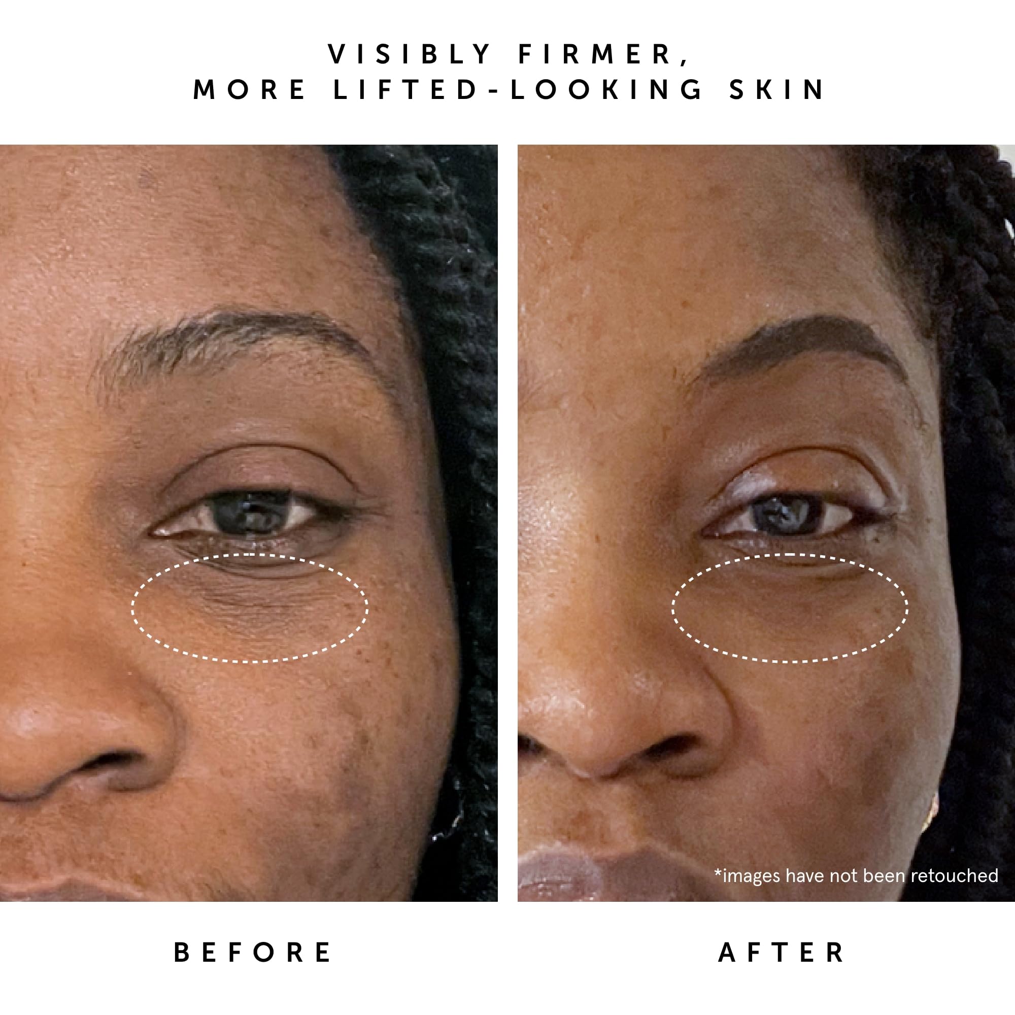 HERBIVORE Serum application night routine demonstrating careful night-dtime use
