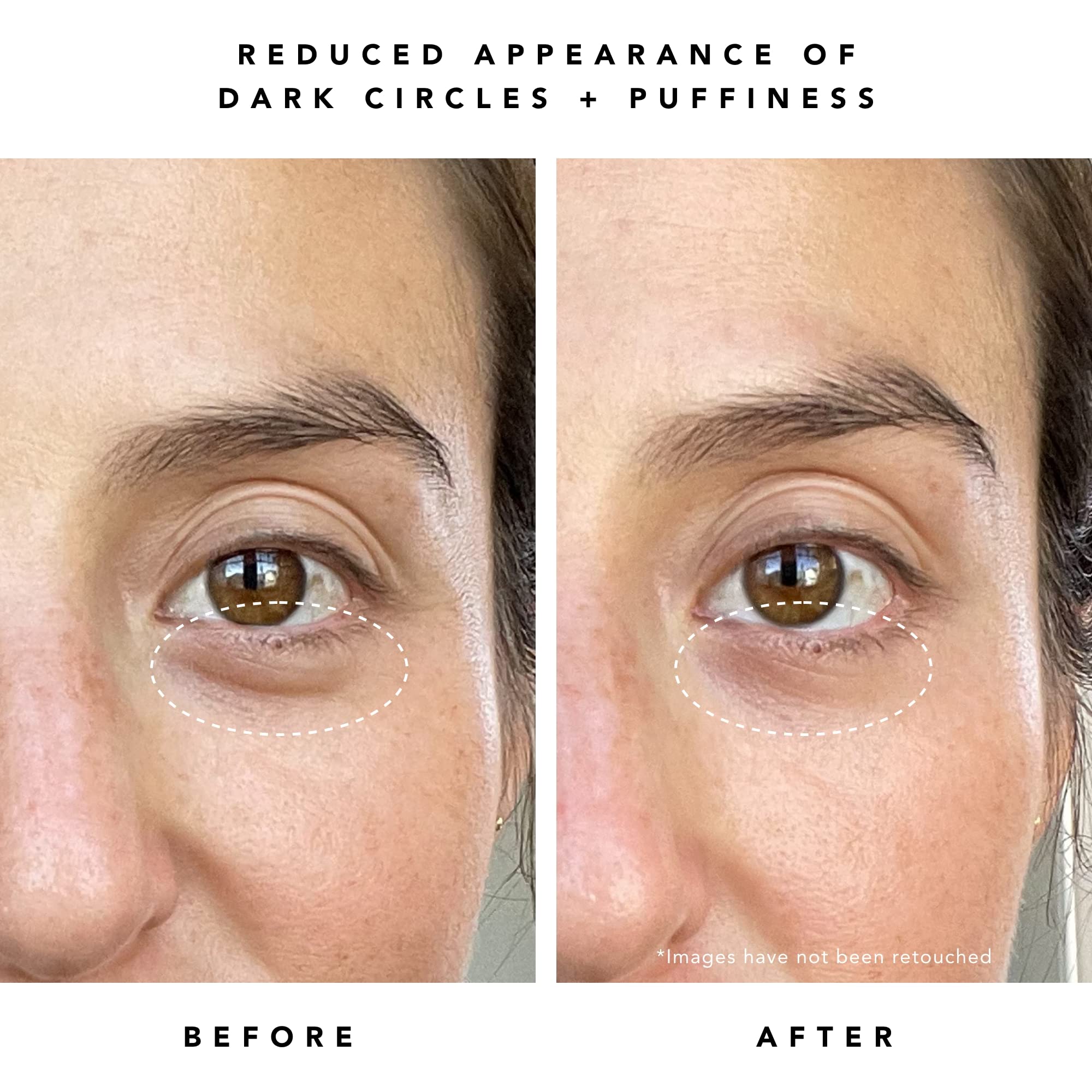 HERBIVORE Super Nova eye cream under-eye area demonstrates a brighter, awake look