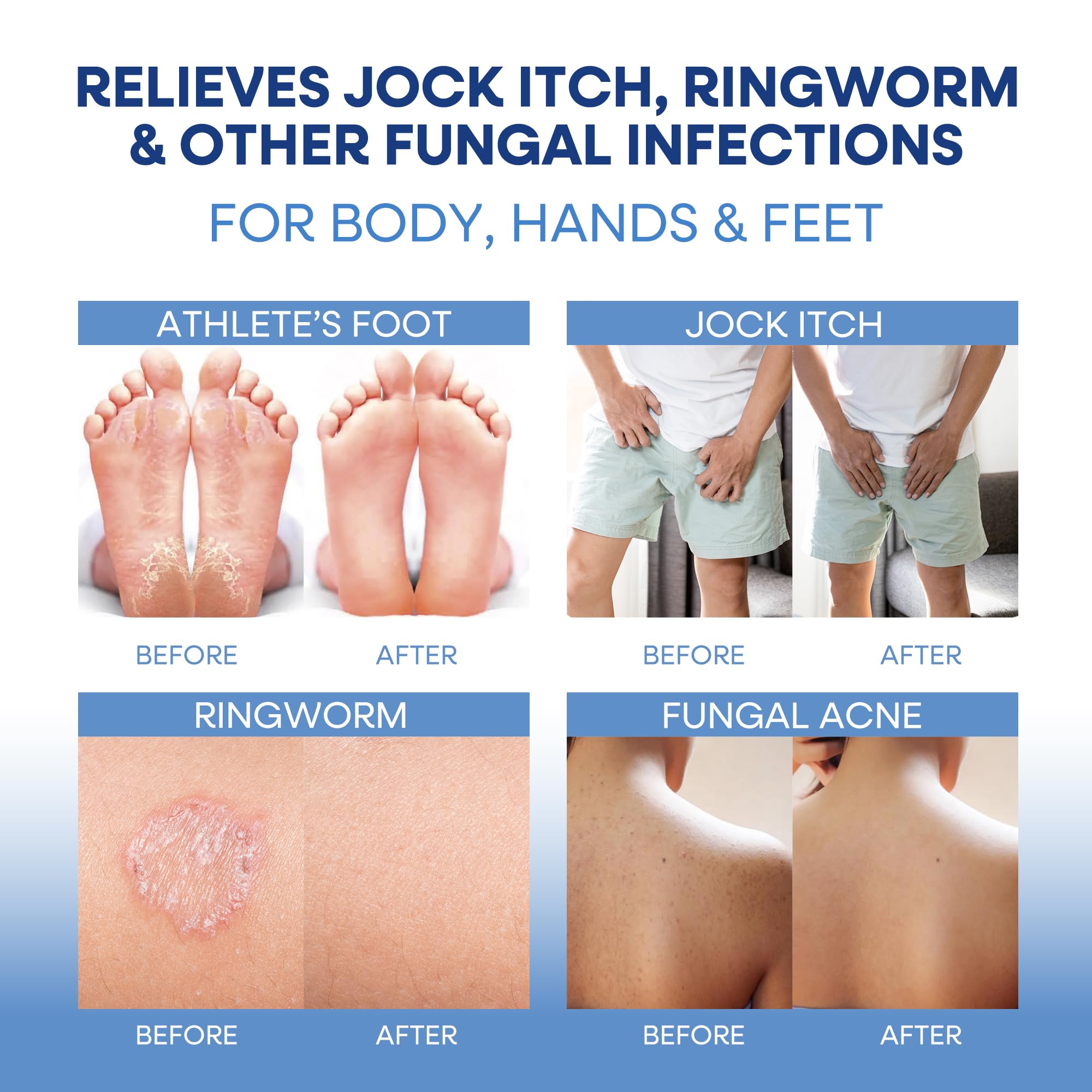 Hermon antifungal soap leaves skin feeling clean and refreshed after use.