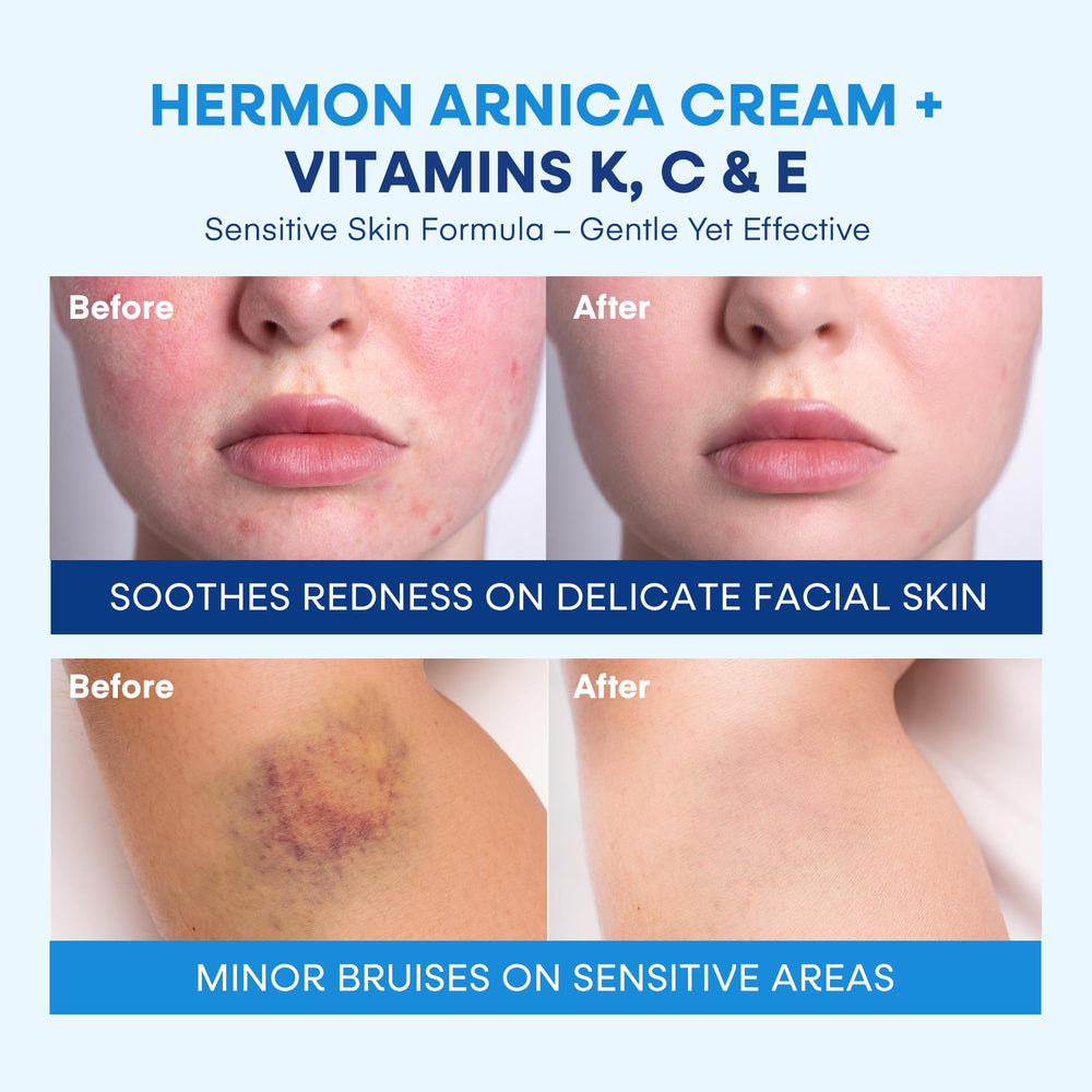Hermon Arnica Creme texture closeup shows rich, creamy formula for massage