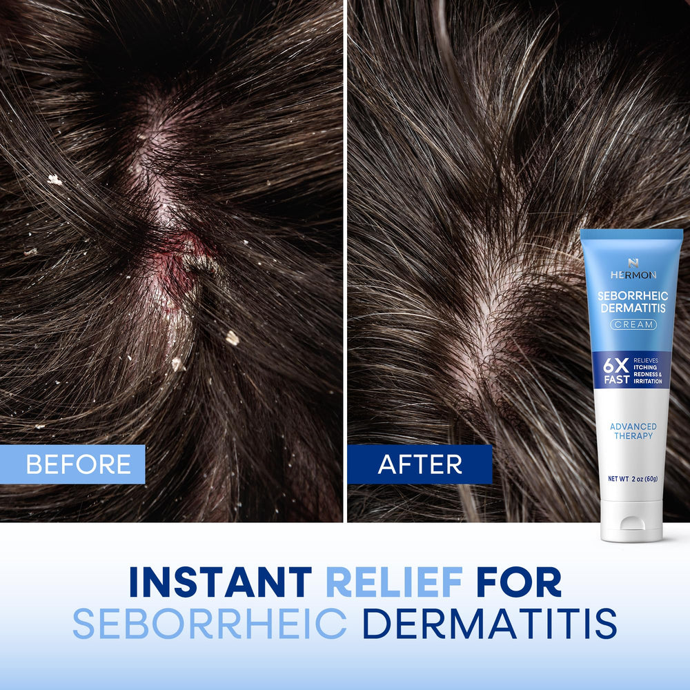 Hermon texture-closeup reveals creamy consistency for sensitive skin