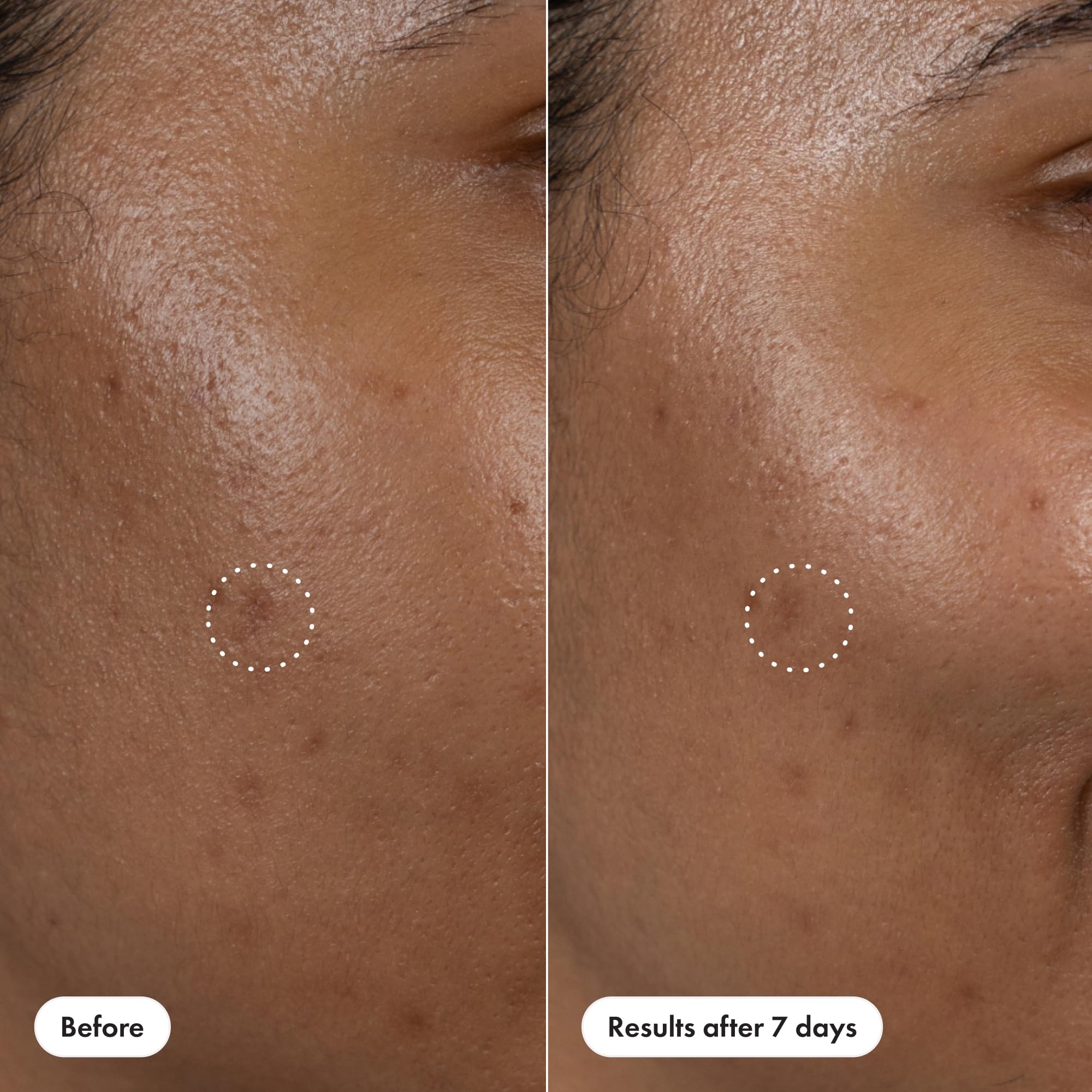 Hero Cosmetics Dark Spot Correct dermatologist-tested non-comedogenic formula