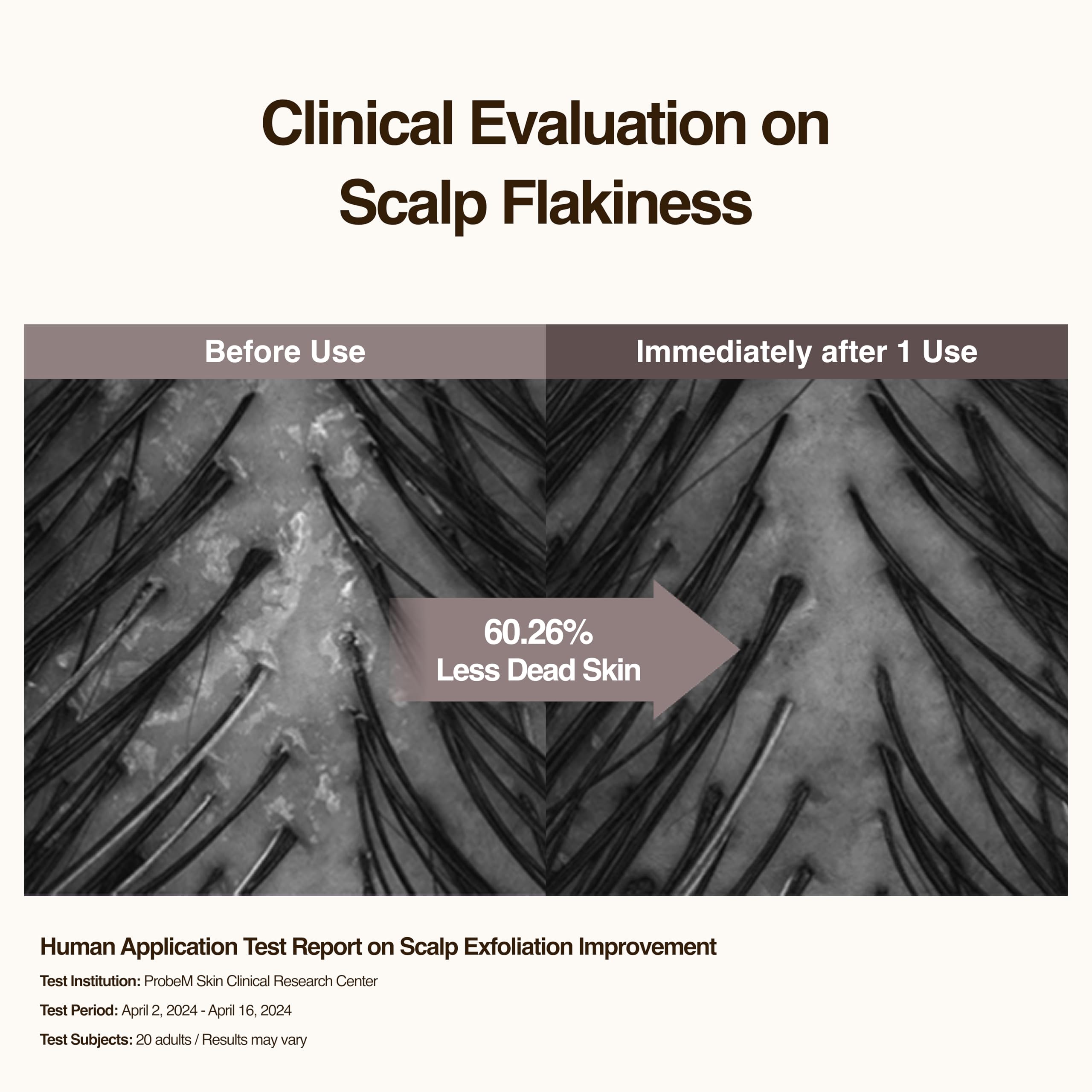Hesul Scalp Ampoule close-up texture suggesting a light, non-greasy finish for sensitive scalps.