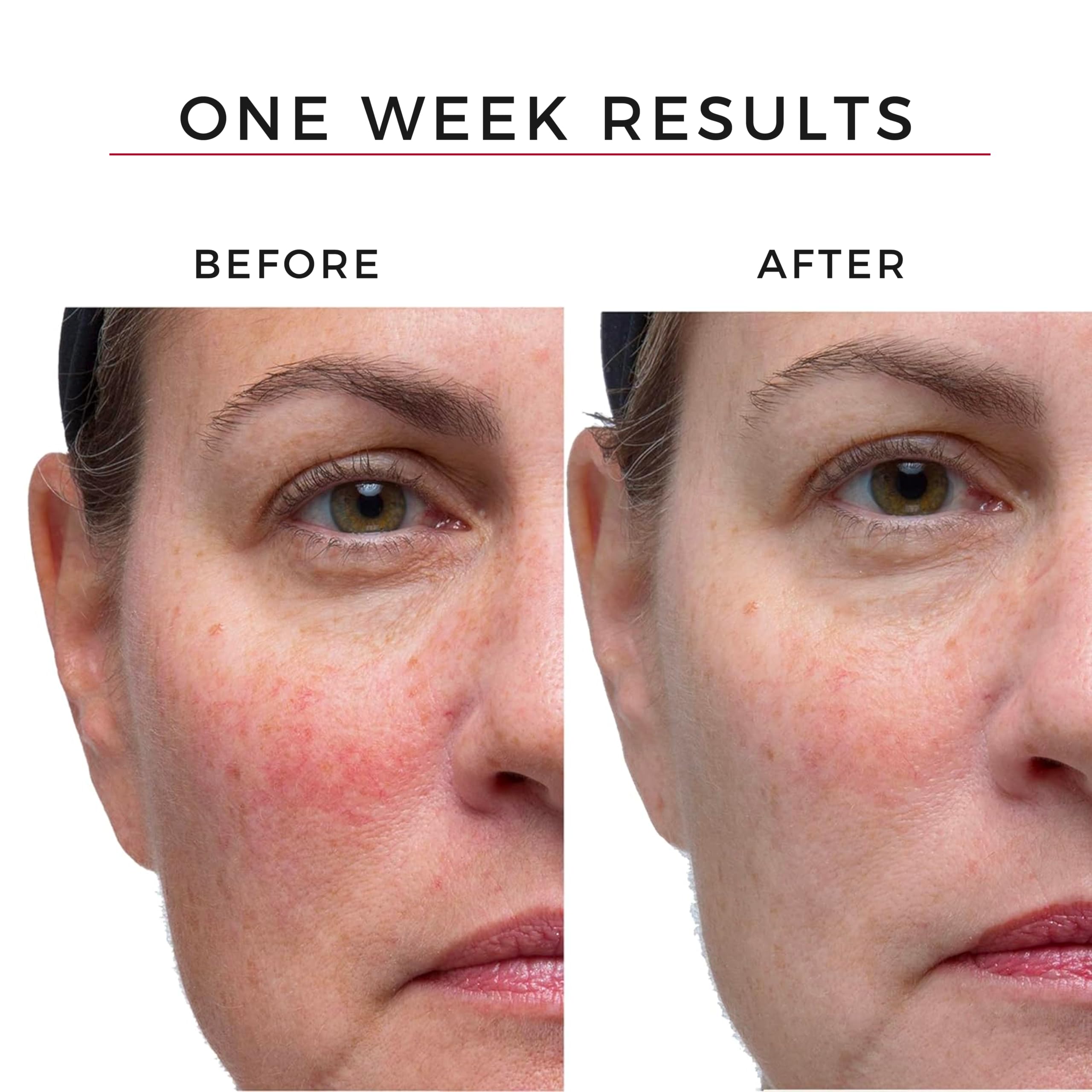 Hey Honey hyaluronic acid and niacinamide ingredients close-up highlighting hydration and plumping potential